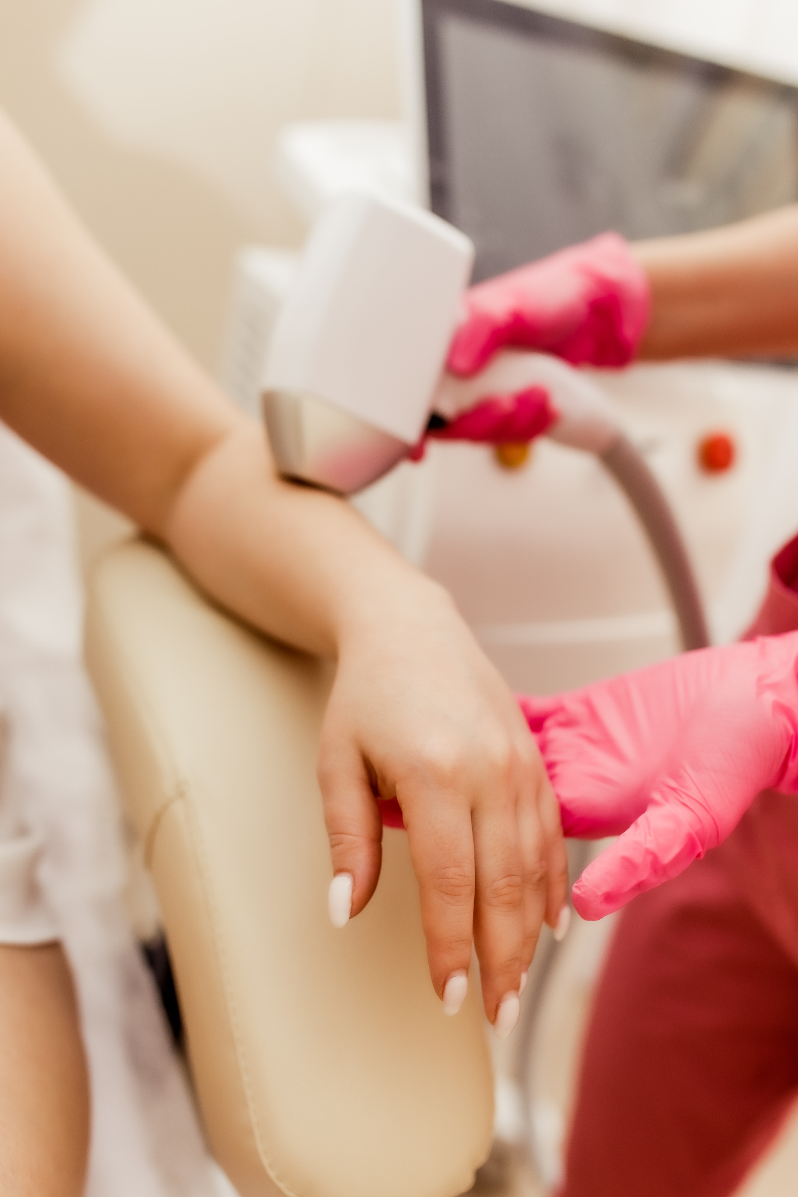 Дарья. Лазерная эпиляция