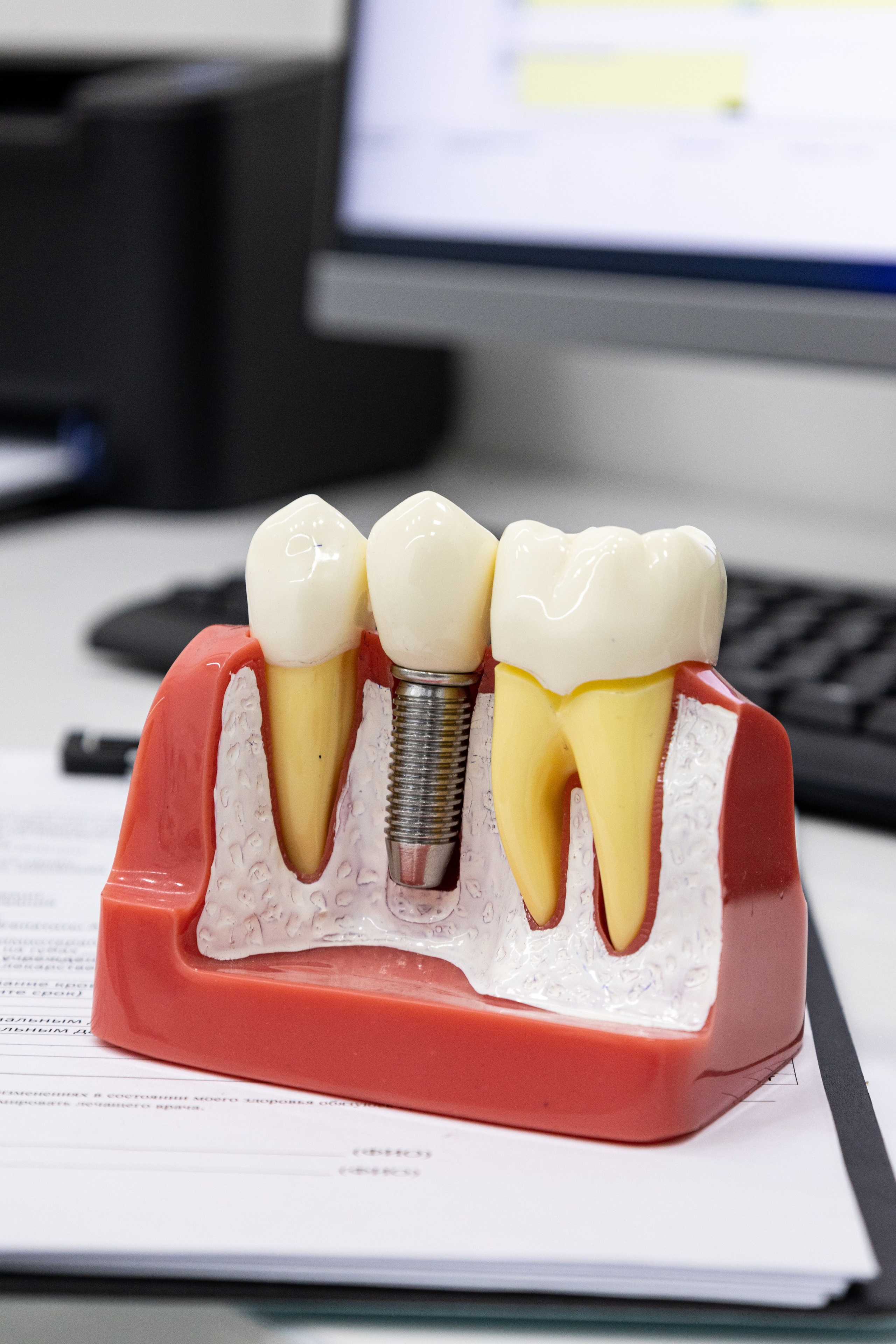 Предметная фотография пластиковых и силиконовых изделий. Предметный фотограф в Москве и Московской области