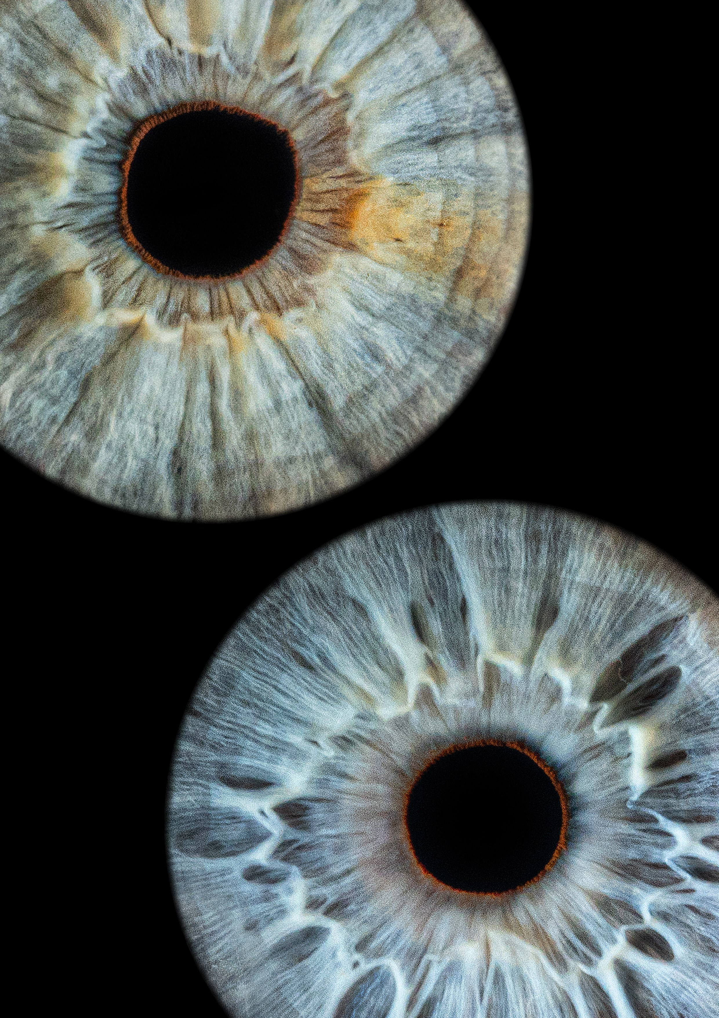 фотография радужки глаза Хабаровск фото радужки глаза Хабаровск