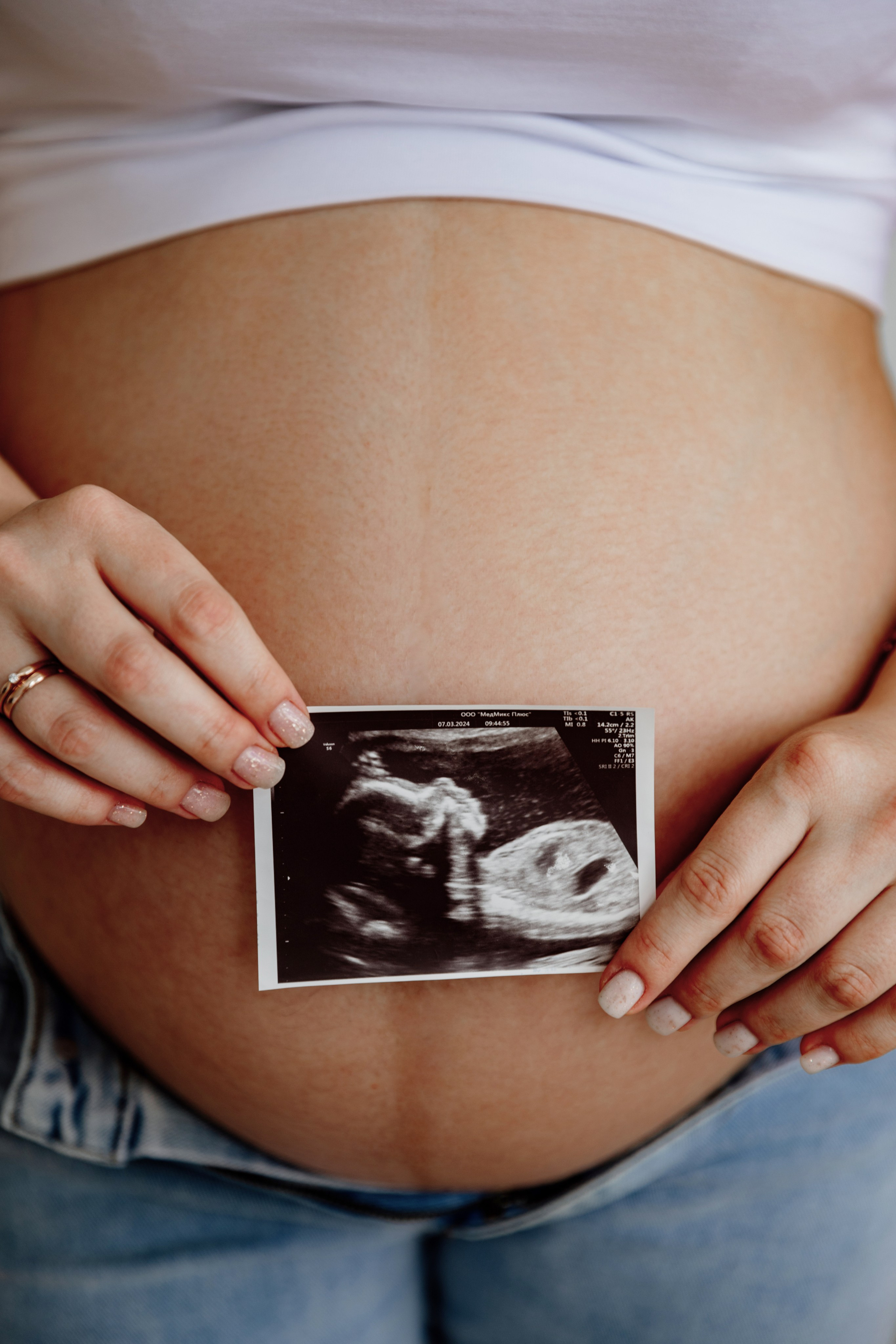 Настя в ожидании. Семейный фотограф документалист в Пензе Лопатинская Татья