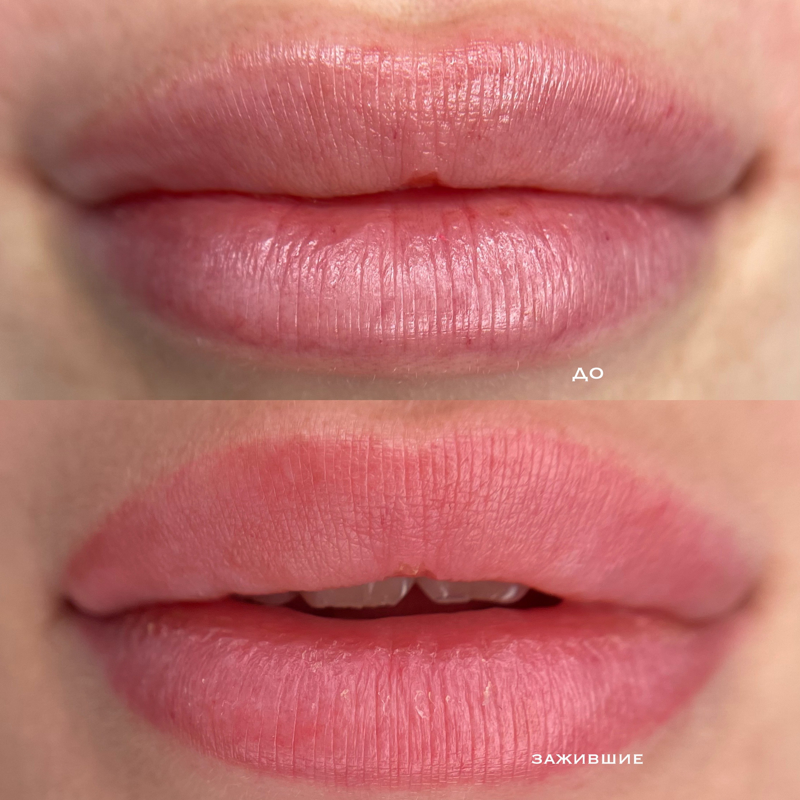 ГУБЫ зажившие. Перманентный макияж и удаление старого татуажа в Ростове-на-Дону Дарья Исакова