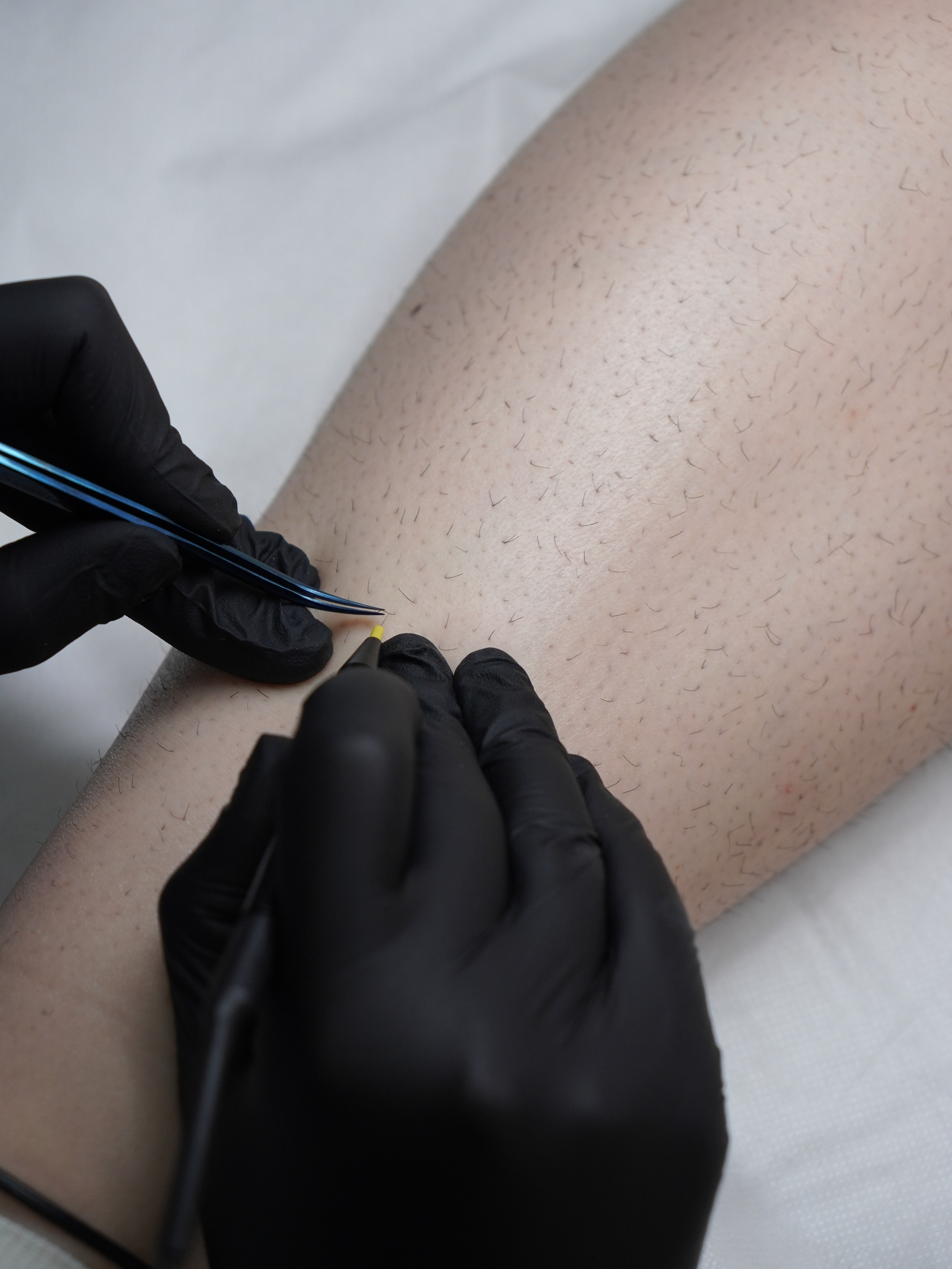 Мастер электроэпиляции Валентина. Фотограф и видеограф в Санкт-Петербурге Хромцова Людмила