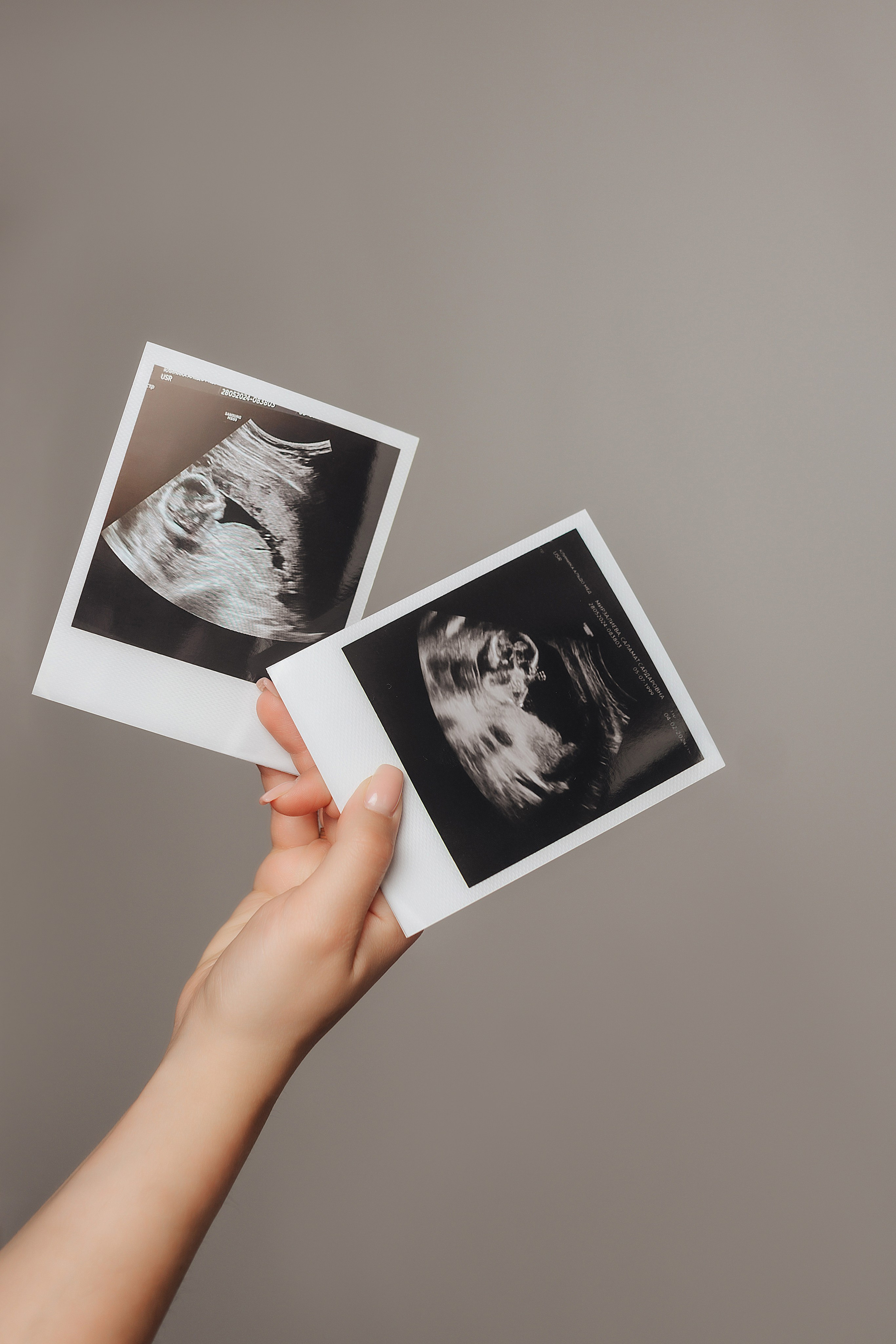 Саламат и Вусал | Съемка беременности. Фотограф Карина Шмулёва. Воронеж и область