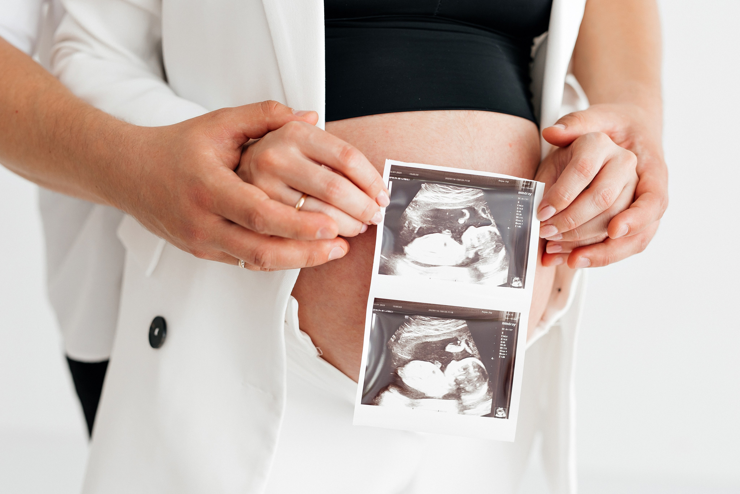 Беременность. Профессиональная детская и семейная фотостудия в Краснодаре