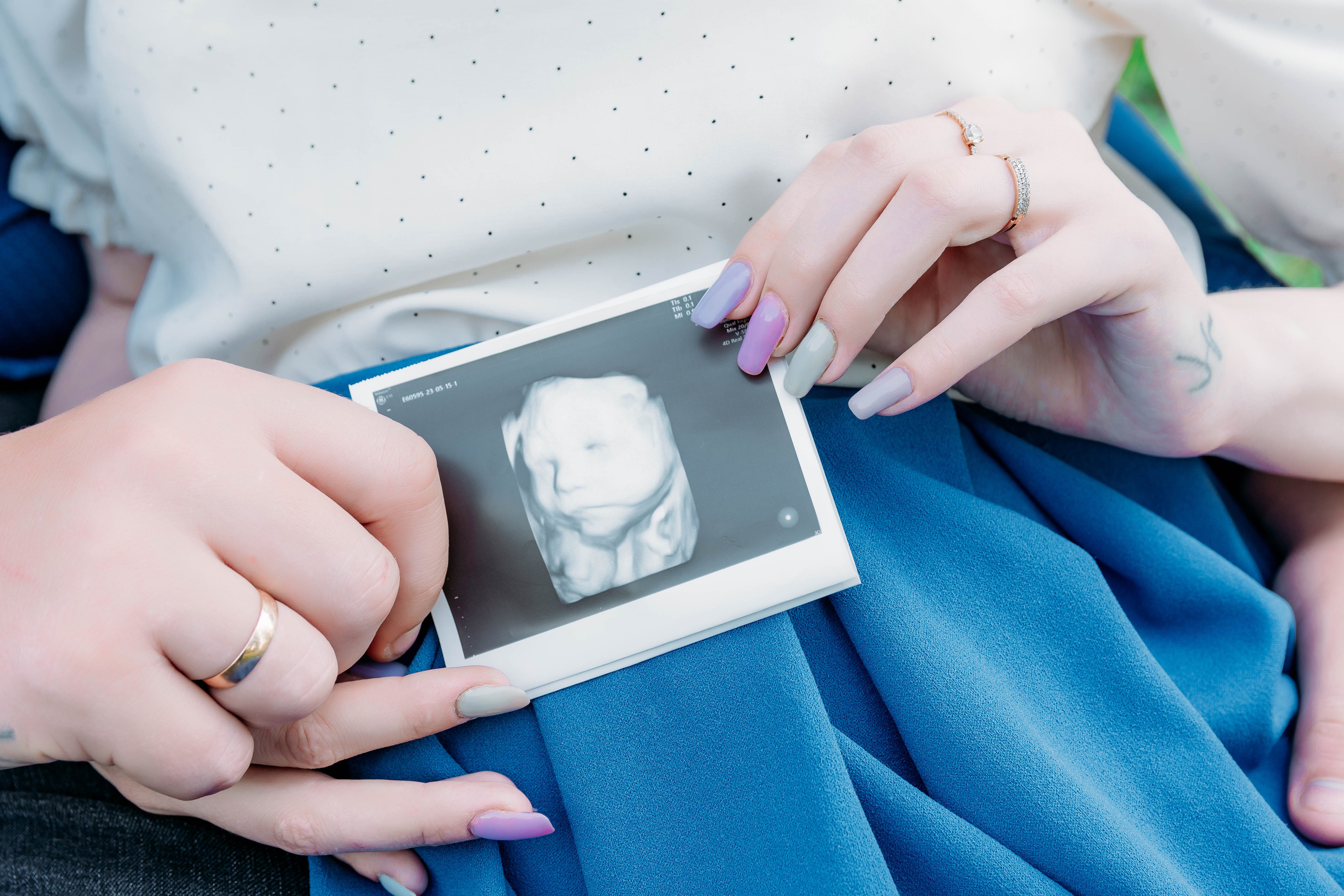 В ожидании. Фотограф Алёна Царькова. Киселевск