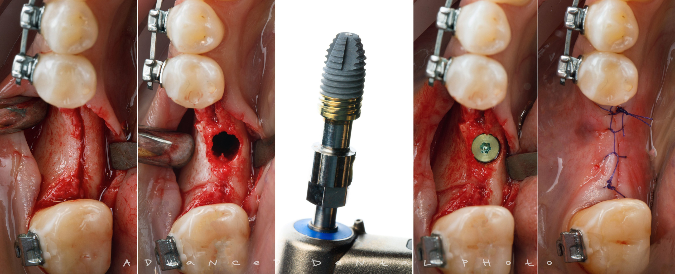 Хирургия. Дентал фотограф — видеограф Денис Дорошенко