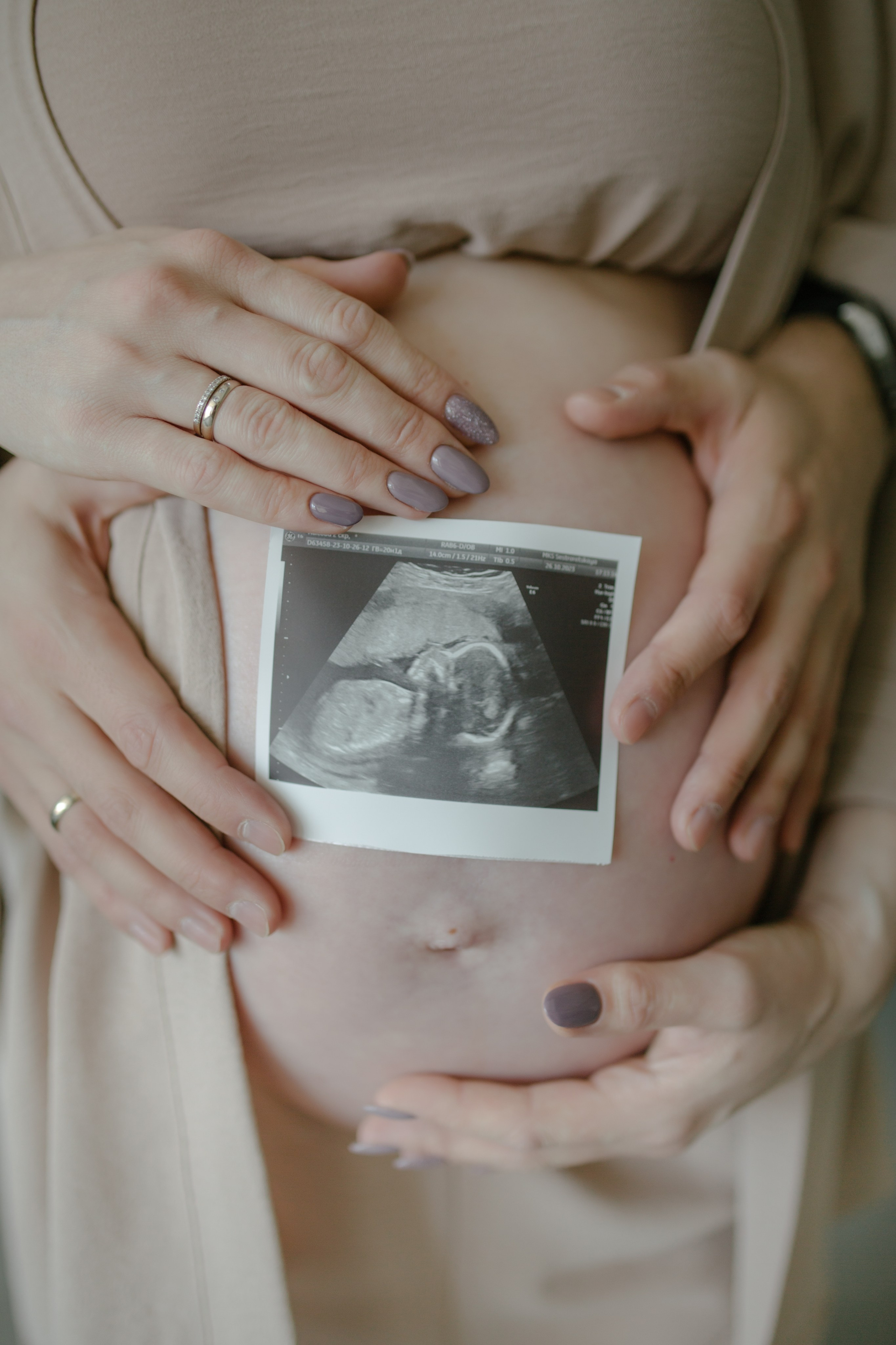 Беременная съемка. Свадебный и семейный фотограф в Санкт-Петербурге Исупова Юлия