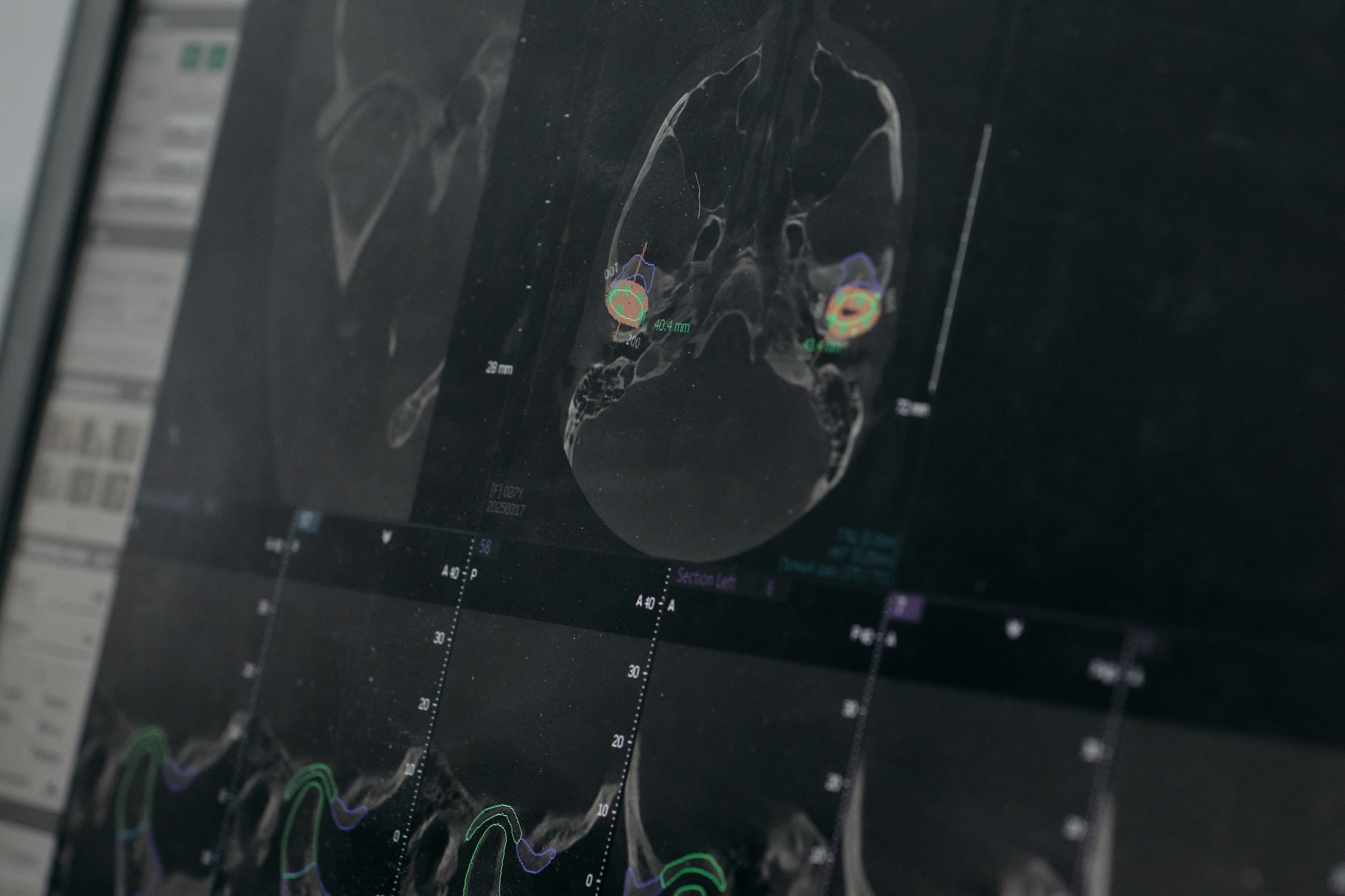 Дентал Салон 2026: Vatech. Свадебный и репортажный фотограф Дмитрий Кононенко