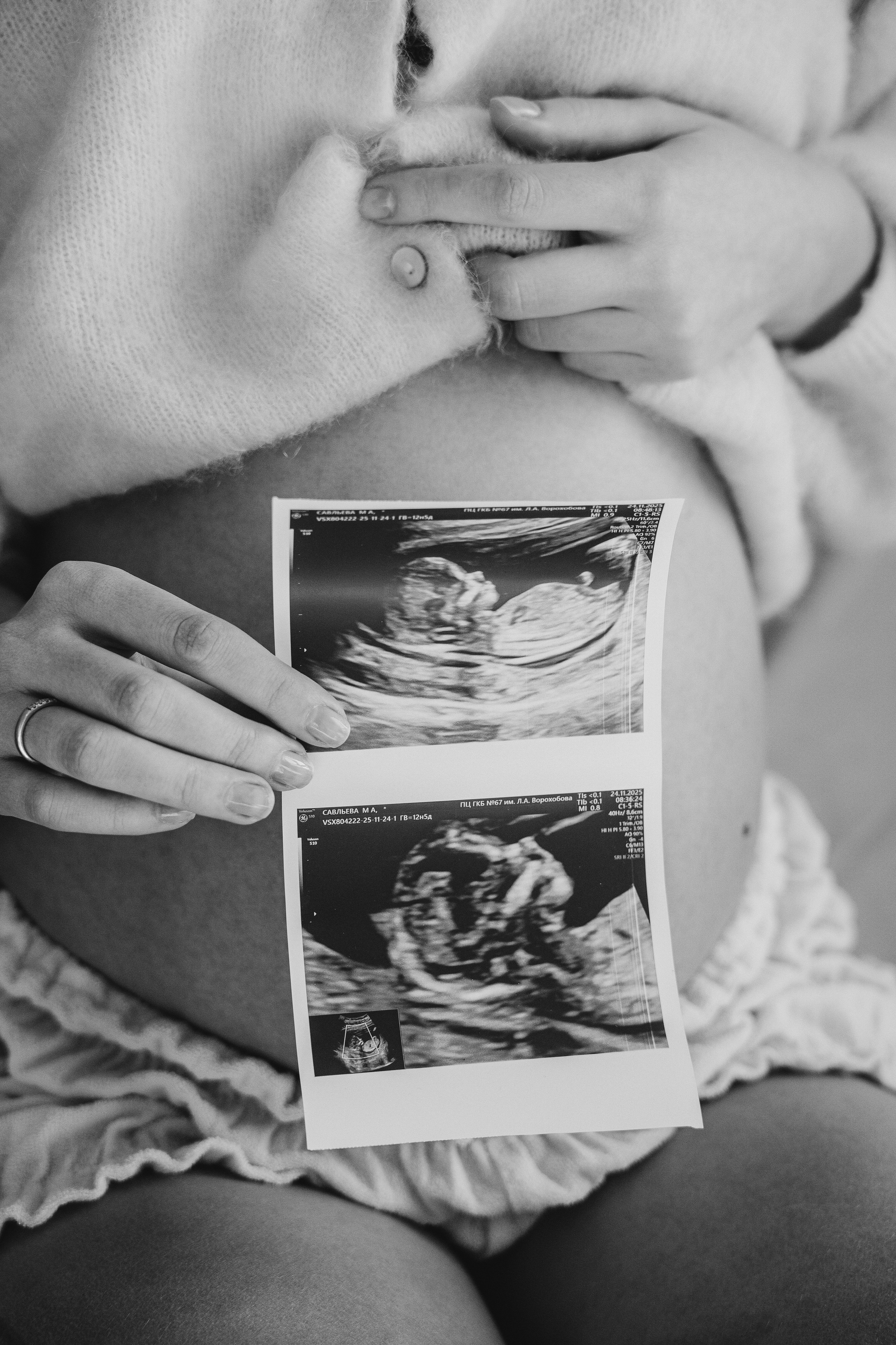 Марина. Беременность. Фотограф/рилсмейкер в Москве и МО. Свадьбы, индивидуальные съемки, лавстори, беременность, мероприятия, бренды