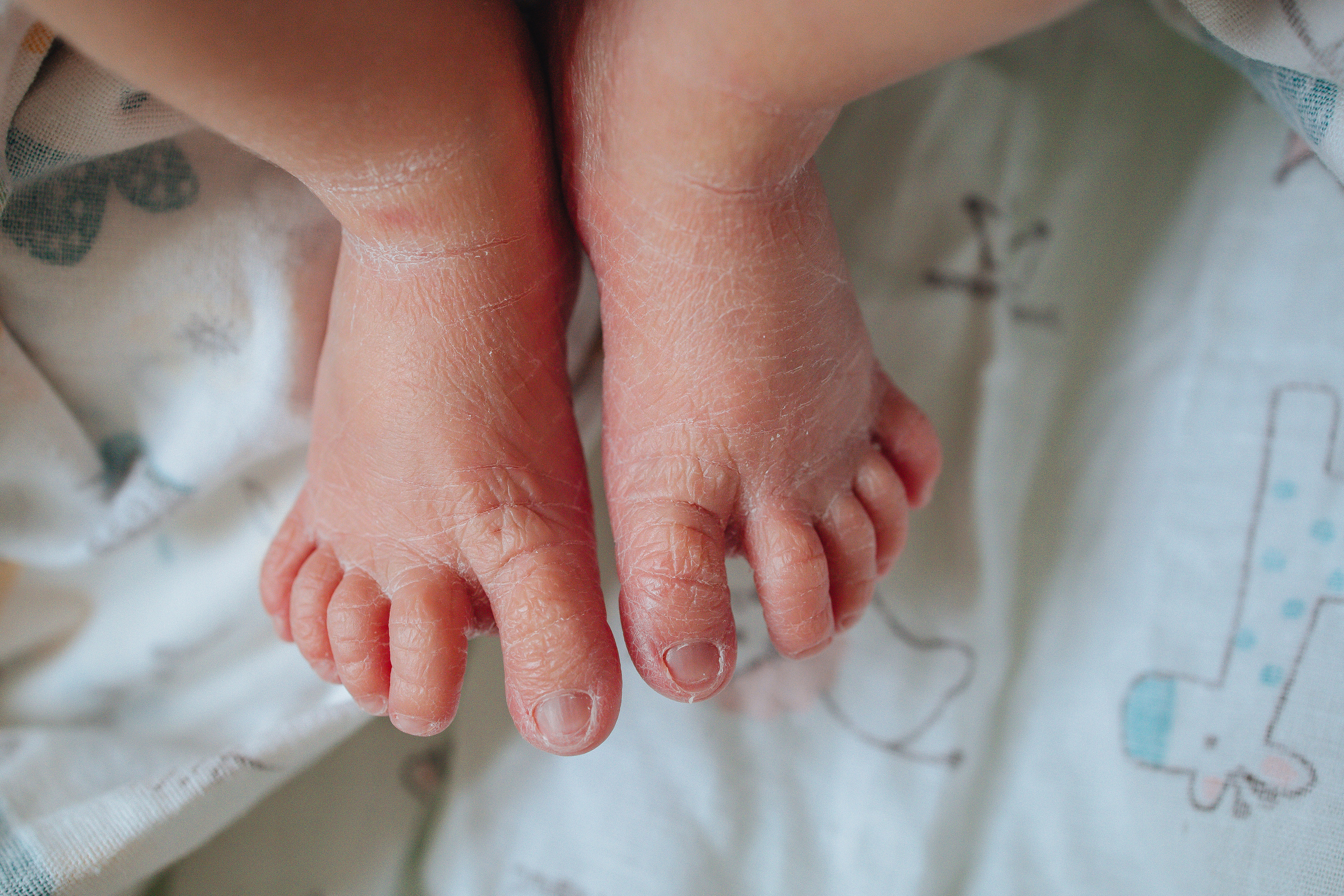 МАЛЫШИ в палате. МиМика — самая детская фотография