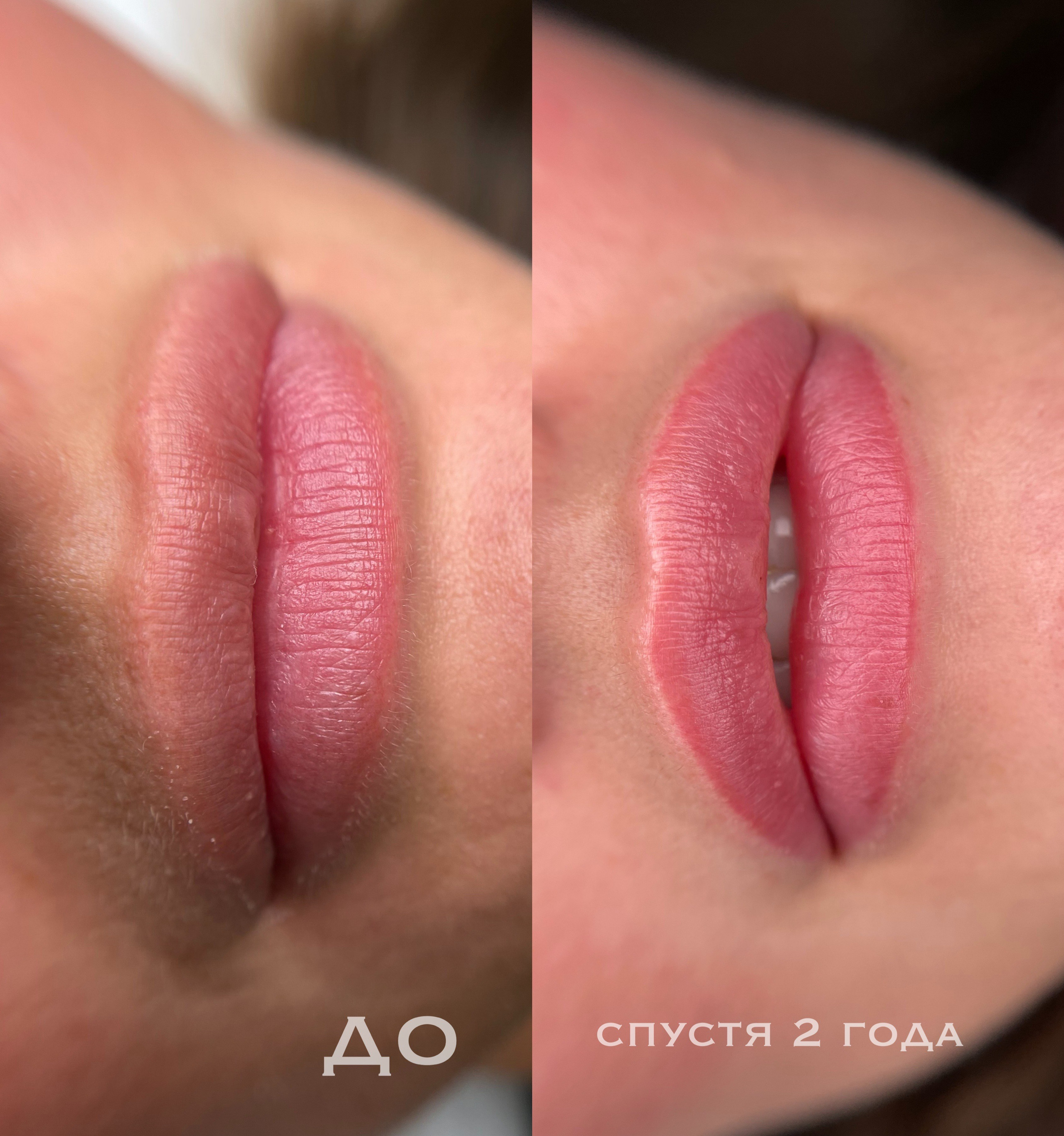 ГУБЫ зажившие. Перманентный макияж и удаление старого татуажа в Ростове-на-Дону Дарья Исакова