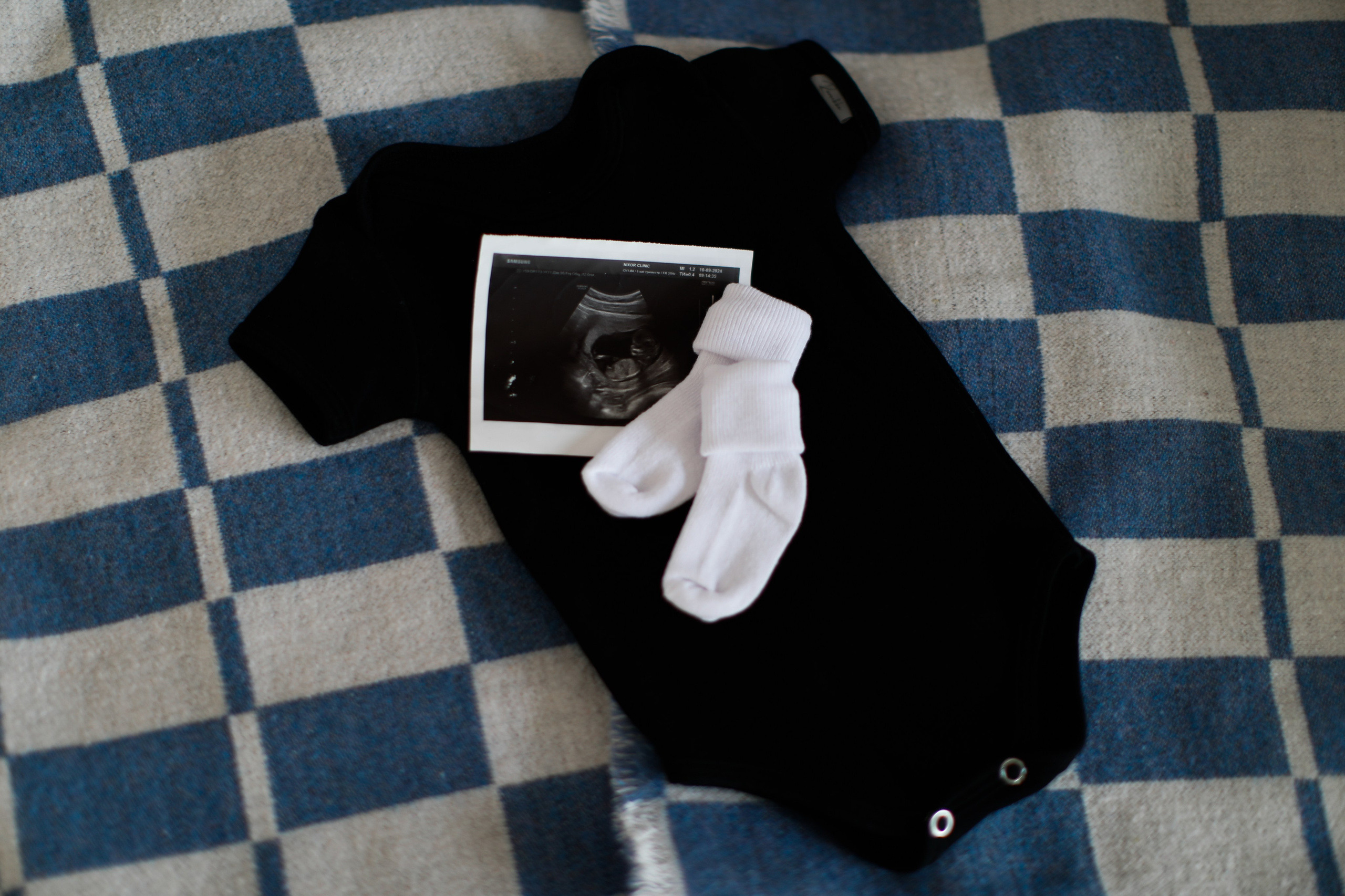 Рождение Евсея. Фотограф Олеся Милош Мытищи, Москва и МО и весь мир