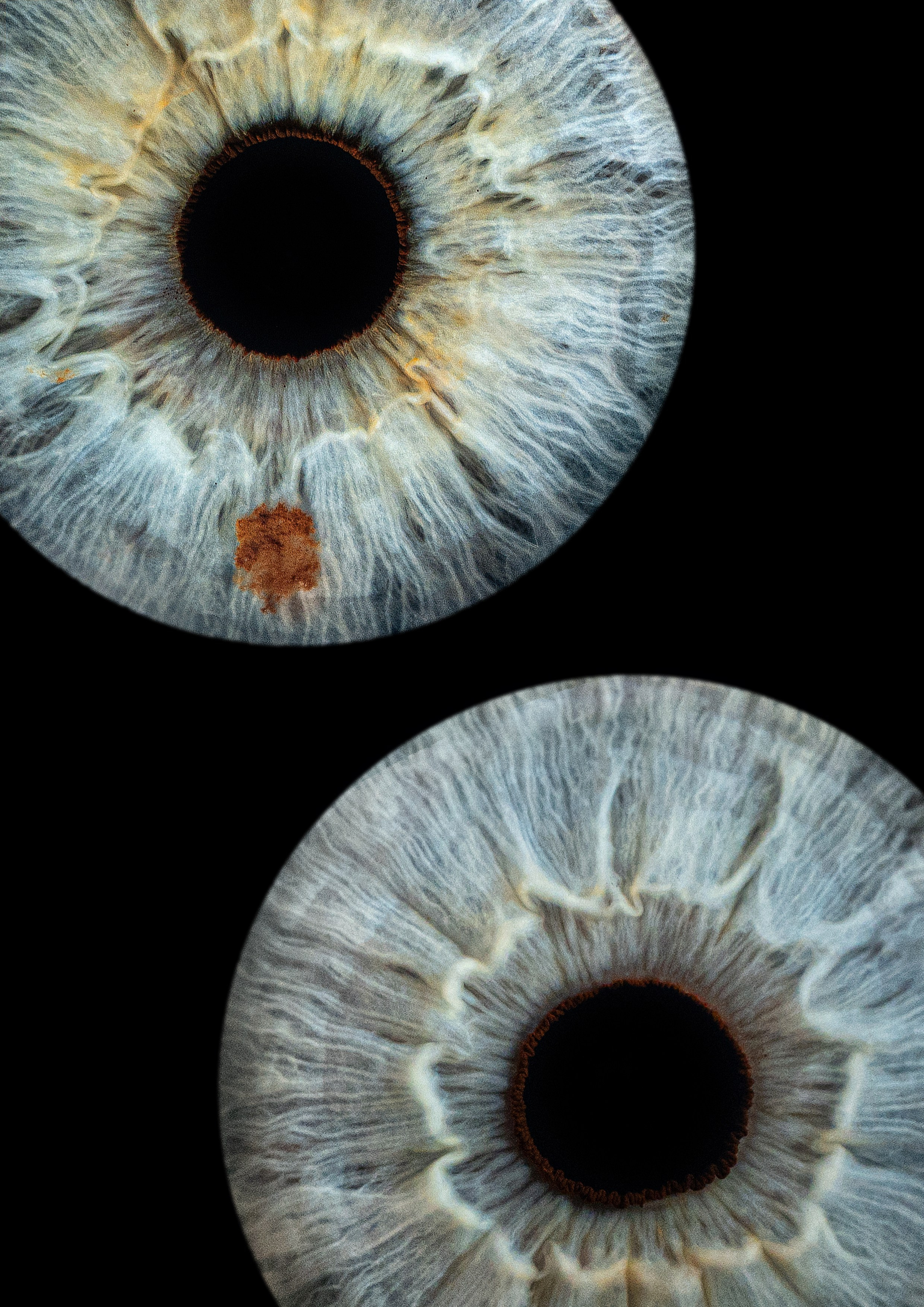 Примеры работ. Мой глаз