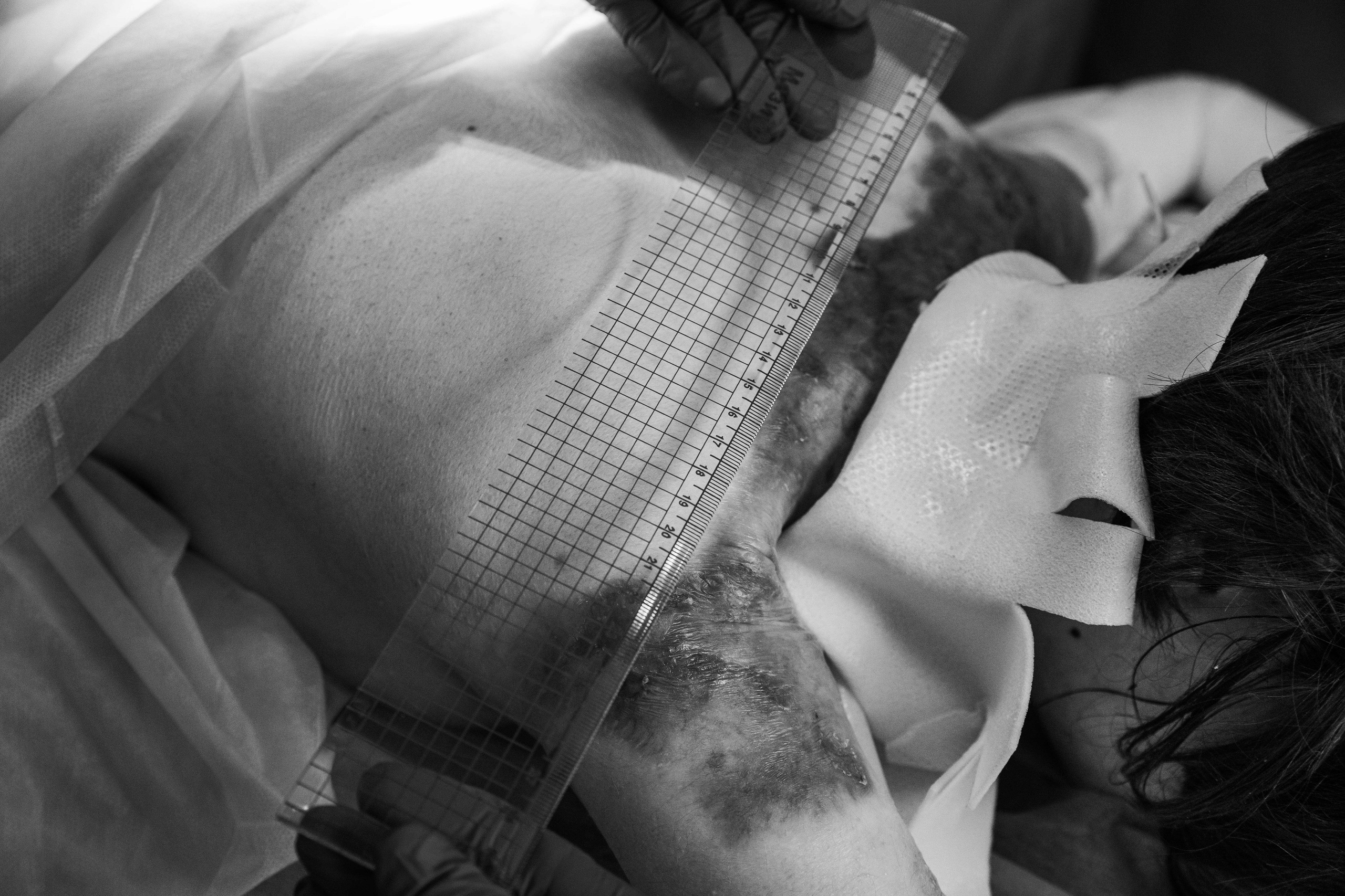 Лекарство для редких бабочек. Фотограф Виталий Верескун. Козельск-Калуга