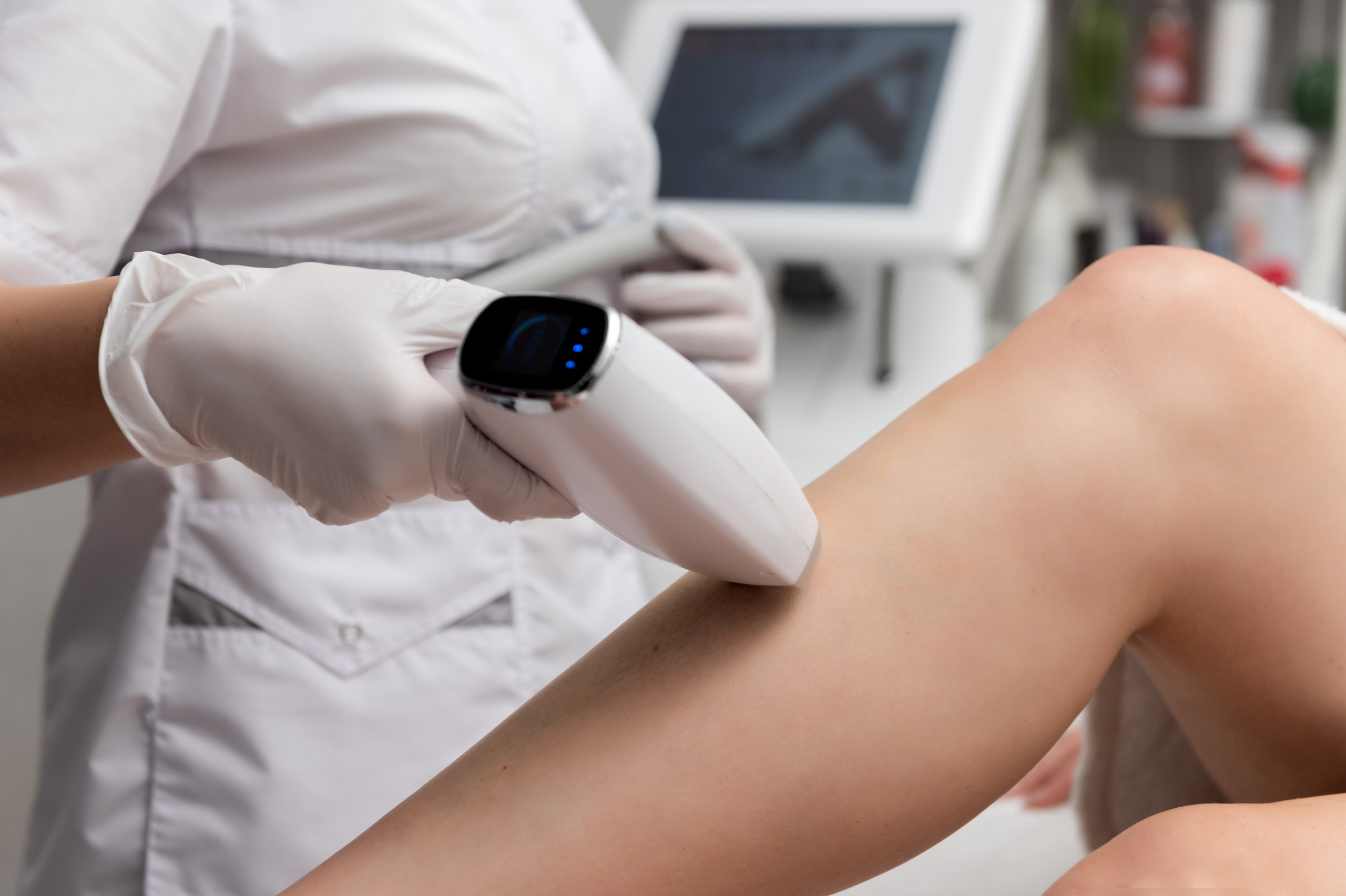 Галерея фото. Лазерная эпиляция в г. Кемерово, г. Новокузнецке и г. Киселевске