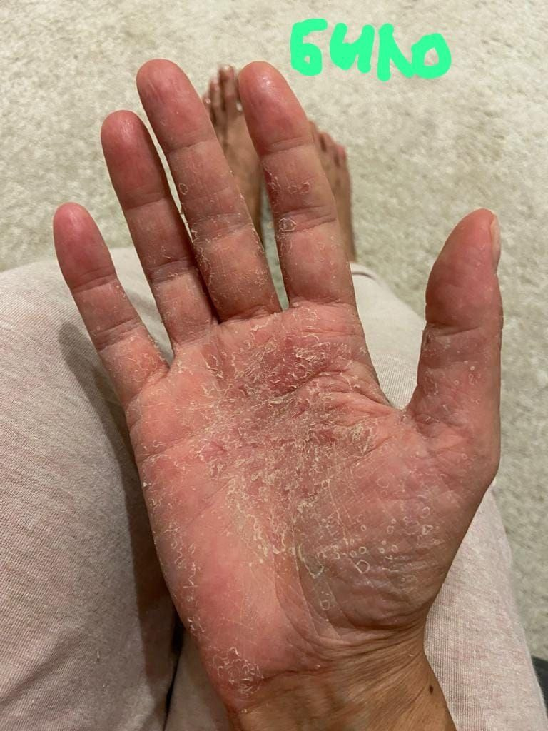 Результаты. Biogenial — Живая формула. Научная точность. Реальное восстановление