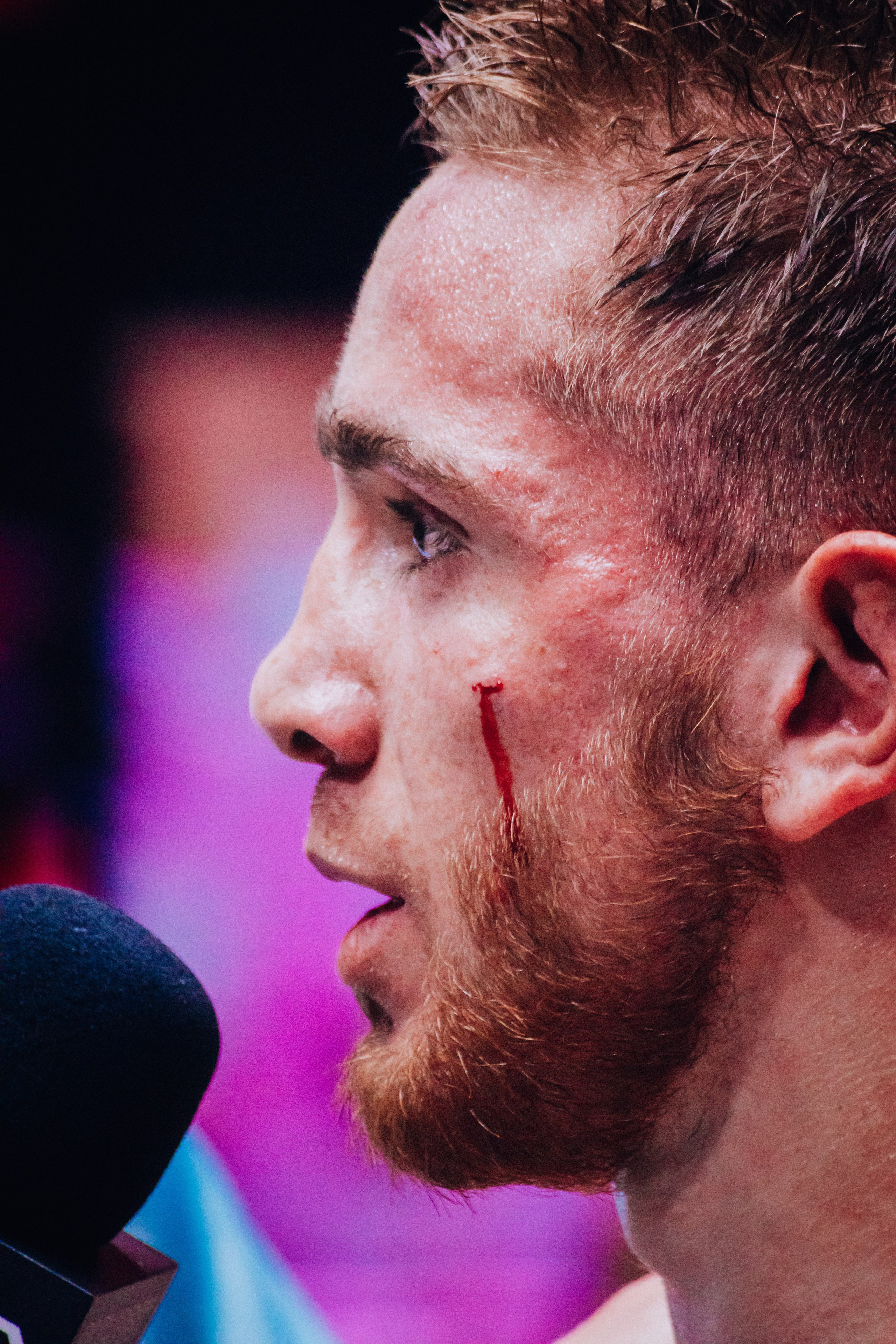 Кулачные бои TopDog. Анастасия Тен