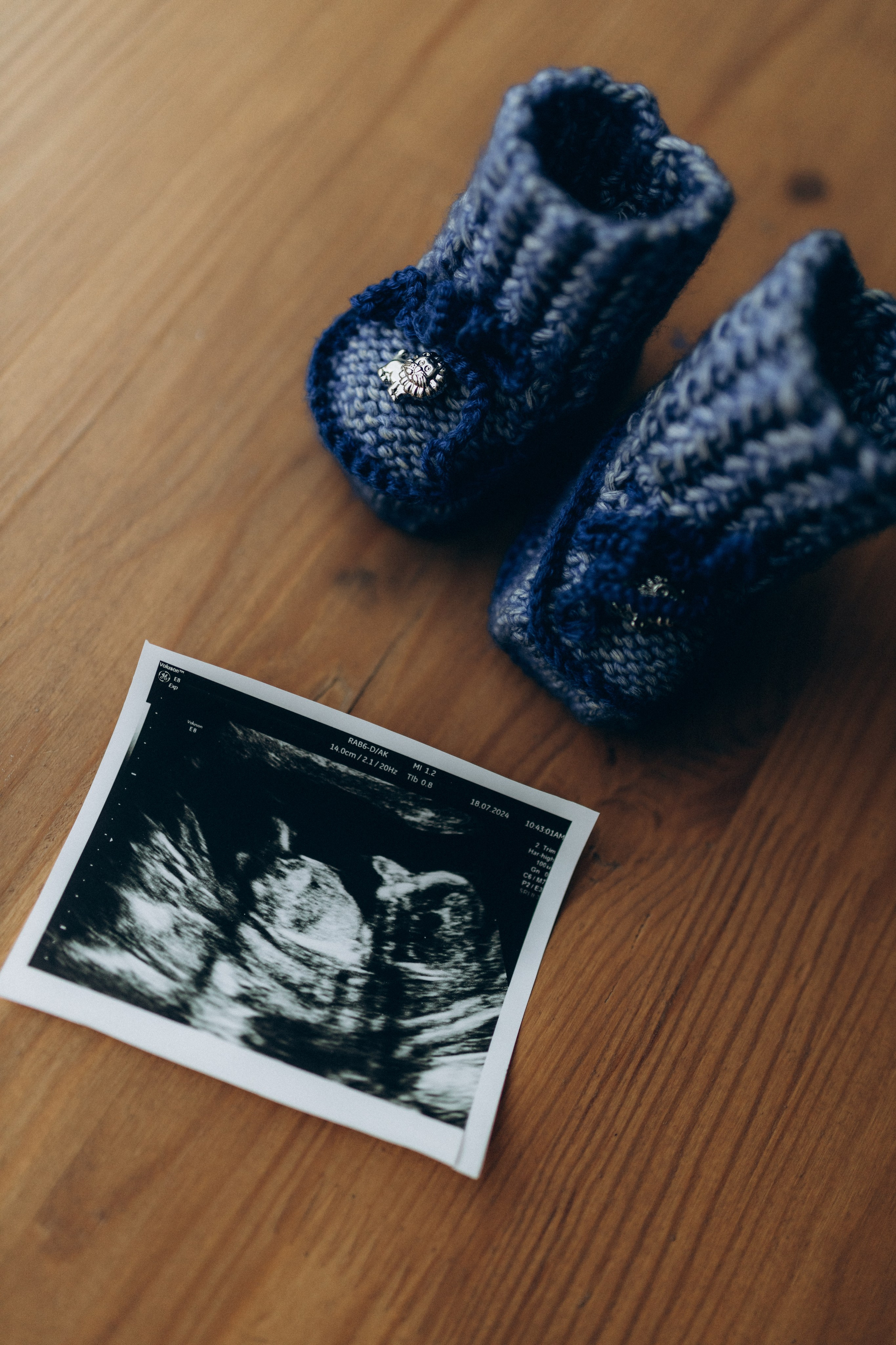 Александра & Дмитрий. Беременность. Фотограф НОГИНСК, Москва, Анастасия Белая