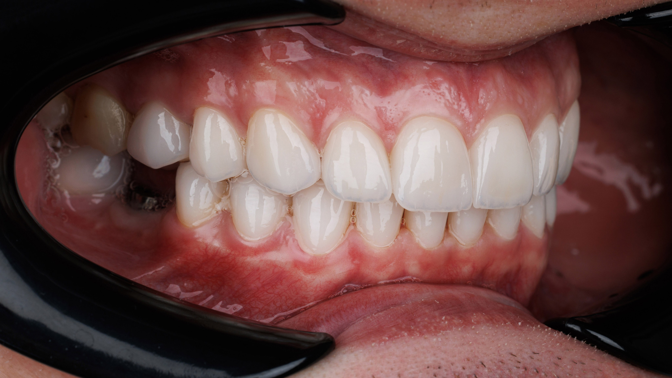 Ортопедия. Дентал фотограф — видеограф Денис Дорошенко