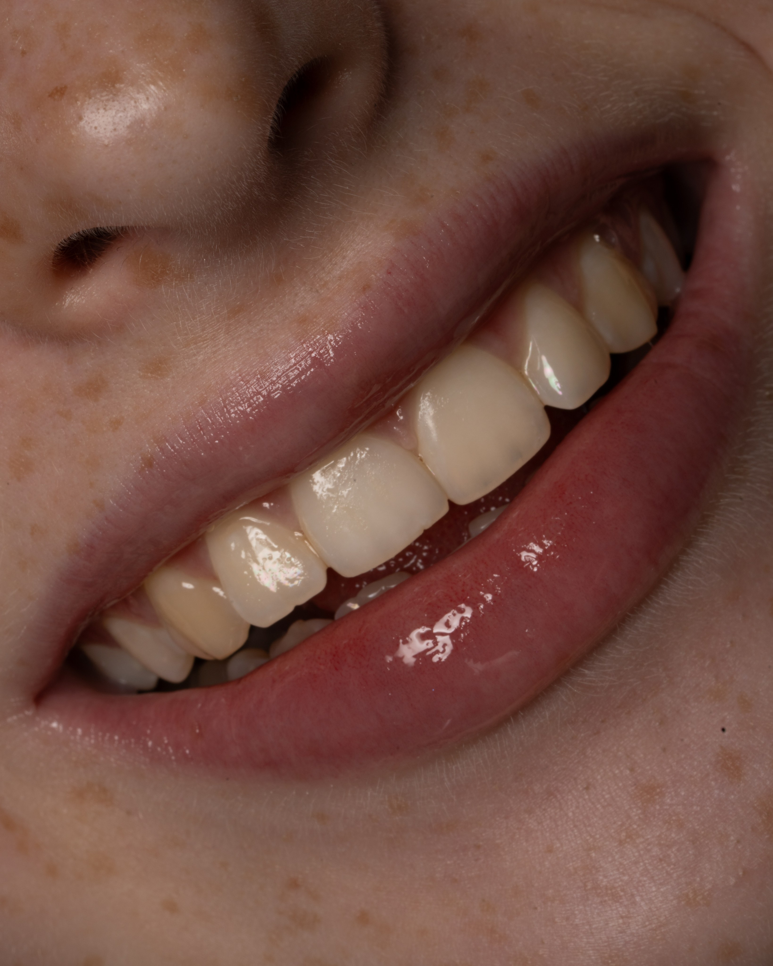 Портфолио. Ретушер фото | High-End ретушь кожи для бьюти, фэшн и рекламы