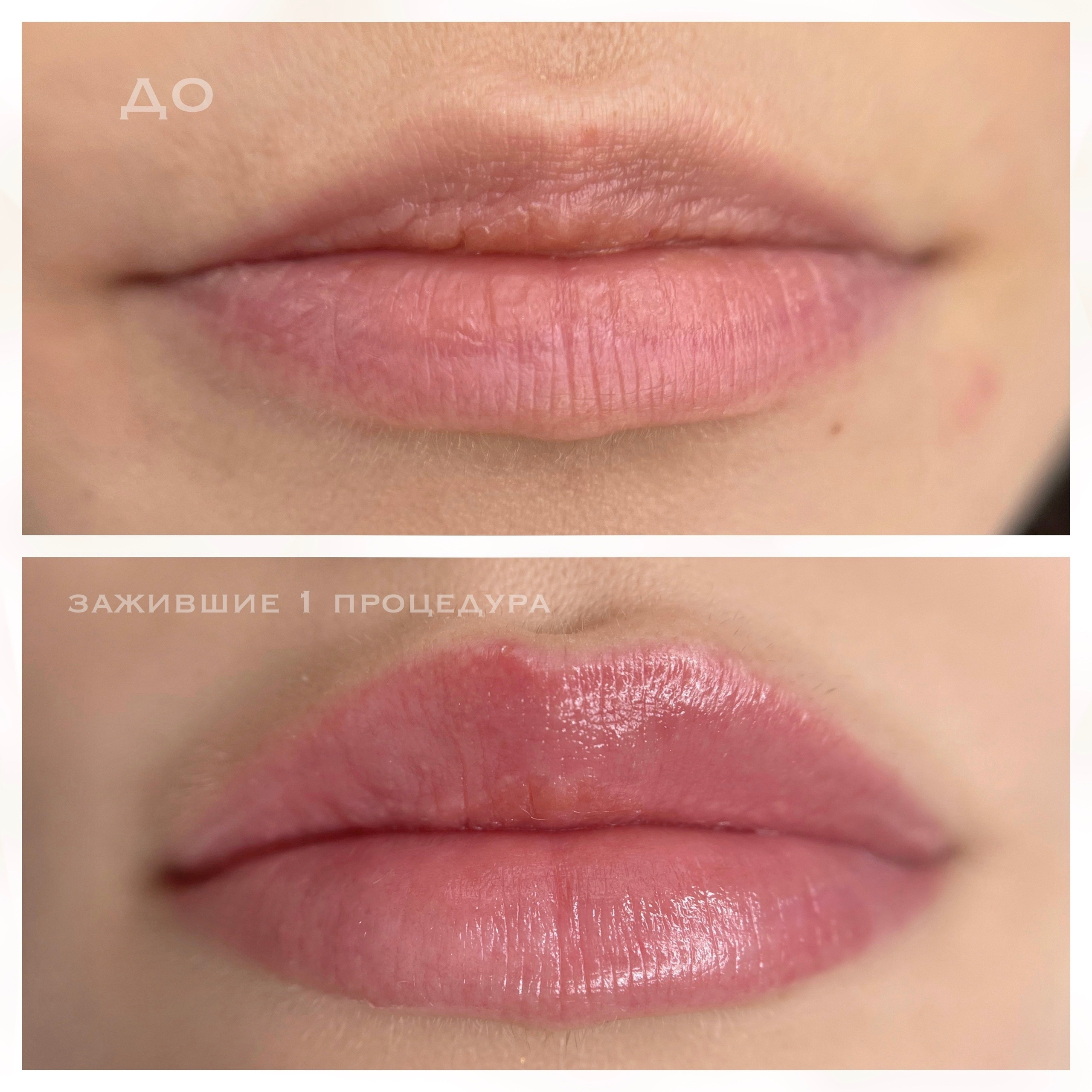 ГУБЫ зажившие. Перманентный макияж и удаление старого татуажа в Ростове-на-Дону Дарья Исакова