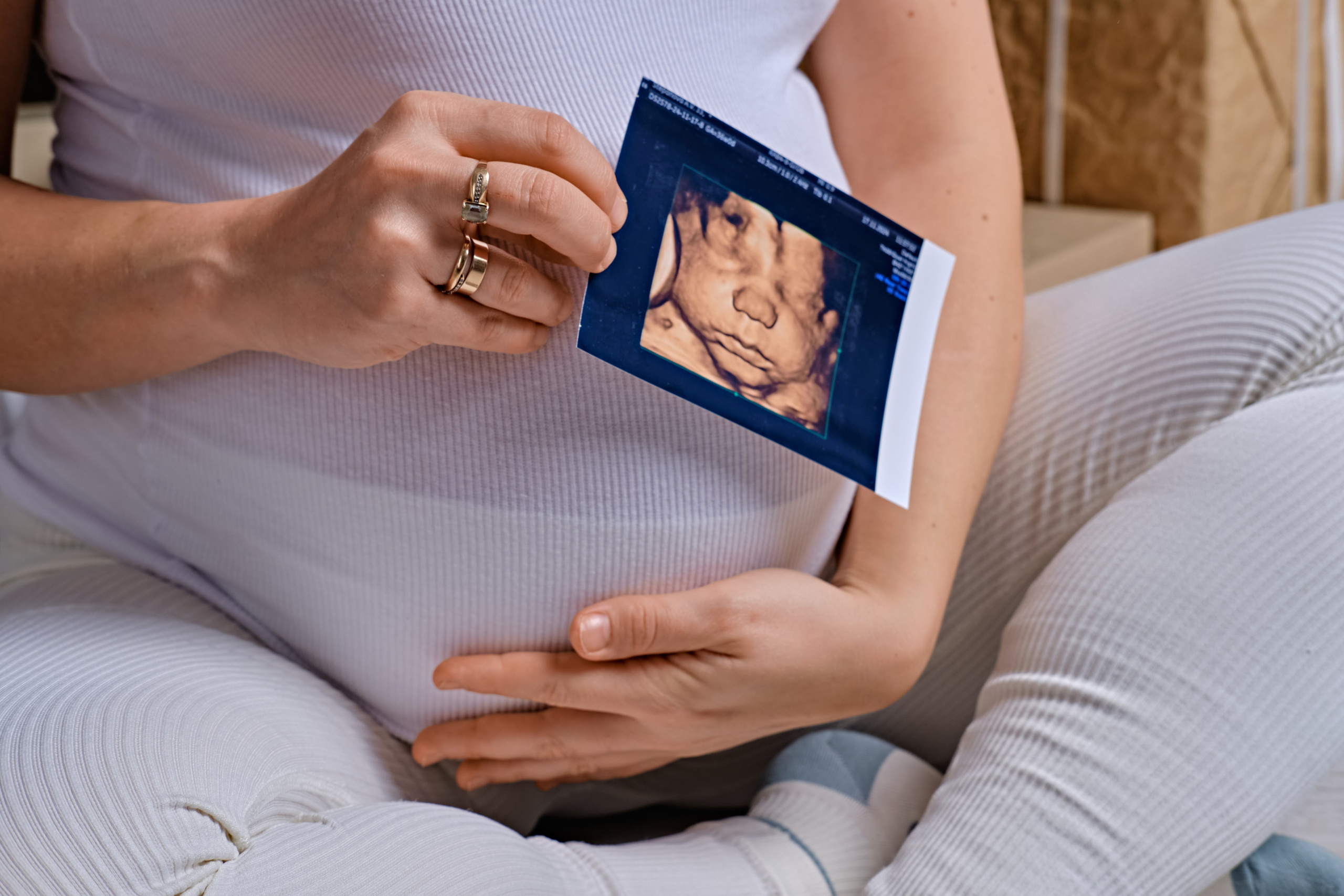 Контентная съемка. К-КАДР — фото и видео для маркетплейсов в СПб