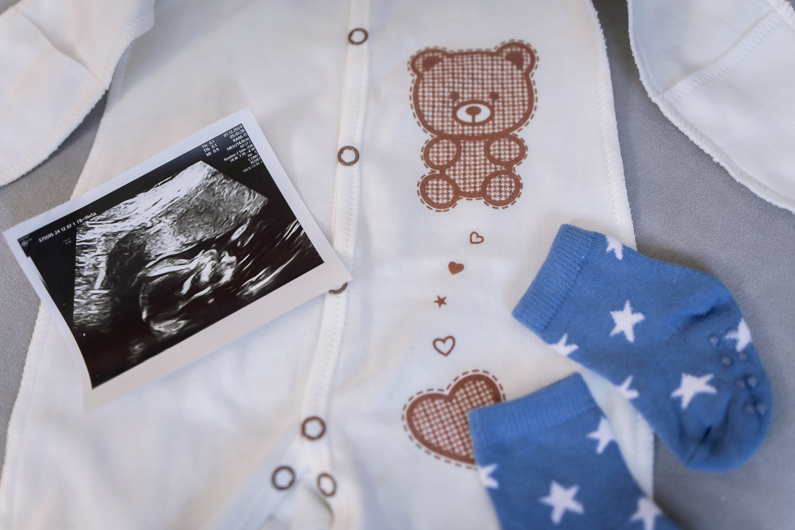 Baby. Anne Miller | Photographer