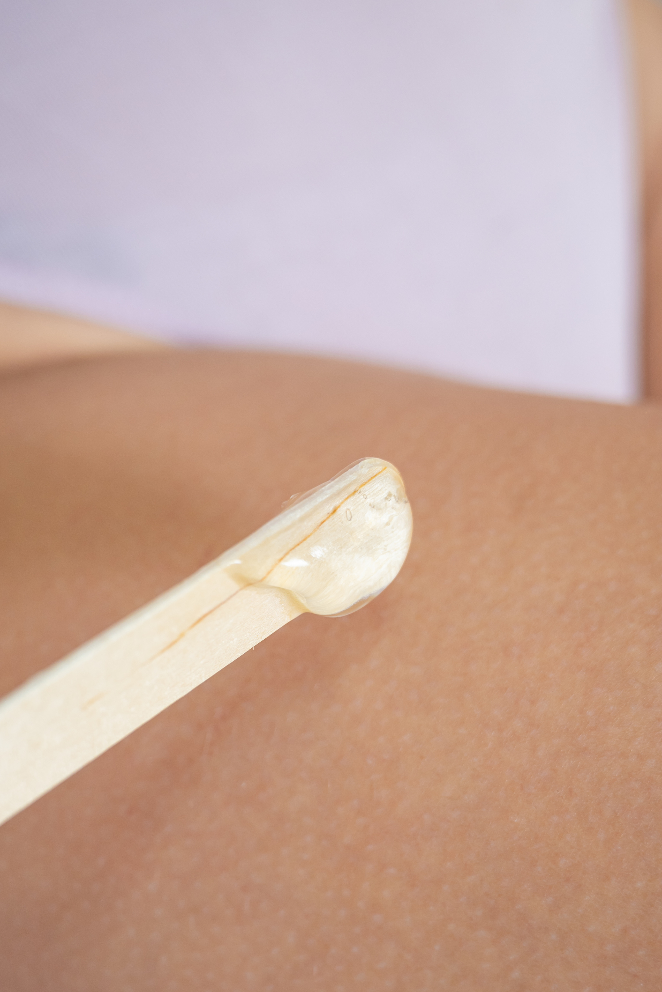 Лазерная эпиляция (Виктория). Свадебный и семейный фотограф Юлия Чернобай | Подольск, Москва, Московская область