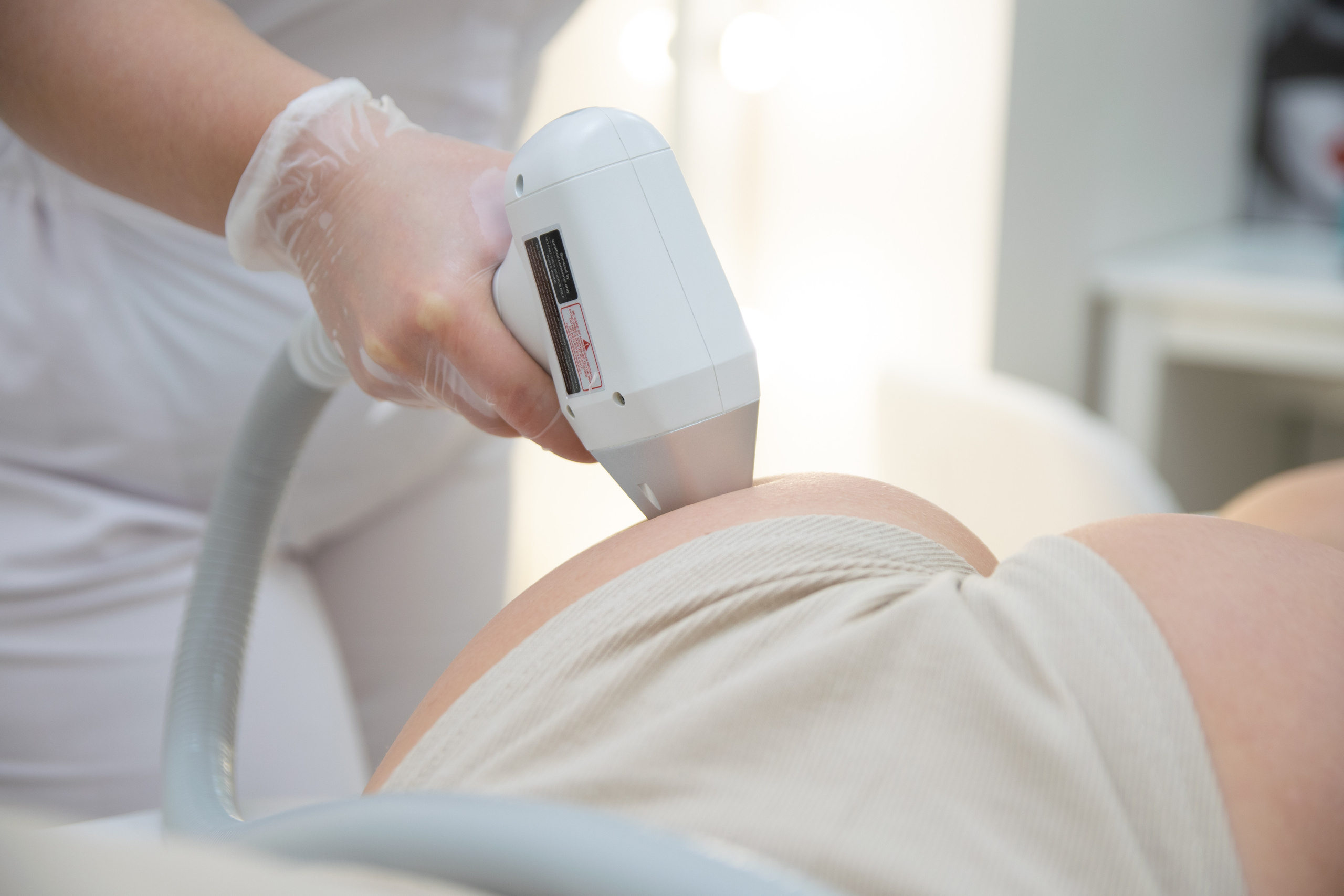 Лазерная эпиляция (Виктория). Свадебный и семейный фотограф Юлия Чернобай | Подольск, Москва, Московская область