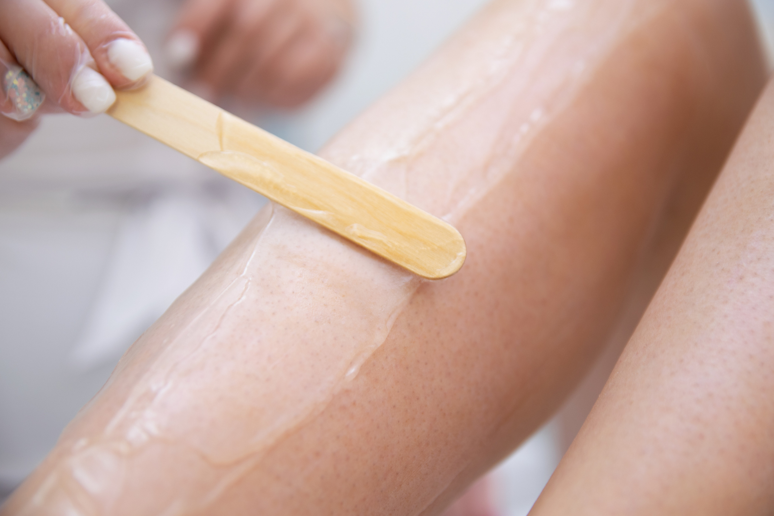 Лазерная эпиляция (Виктория). Свадебный и семейный фотограф Юлия Чернобай | Подольск, Москва, Московская область