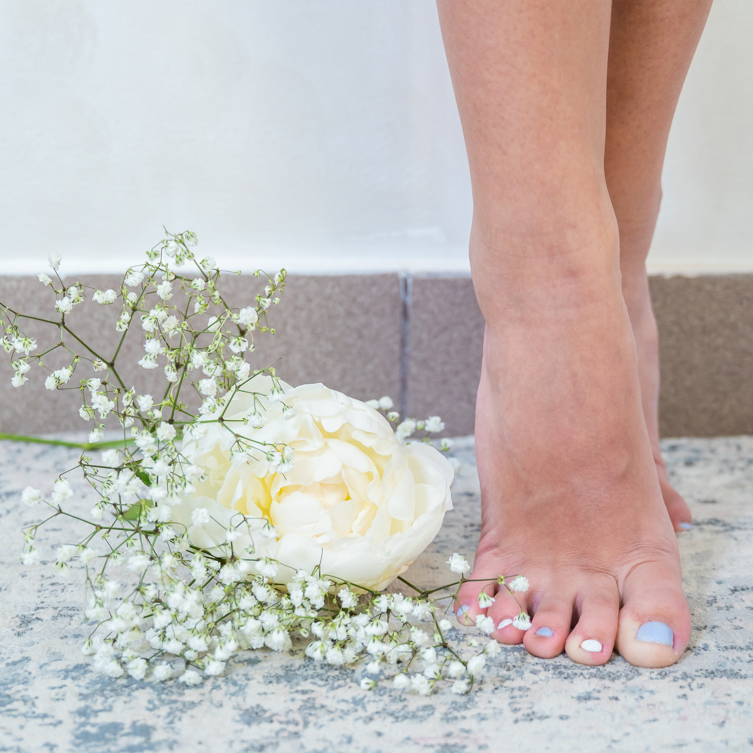 Лазерная эпиляция (Виктория). Свадебный и семейный фотограф Юлия Чернобай | Подольск, Москва, Московская область