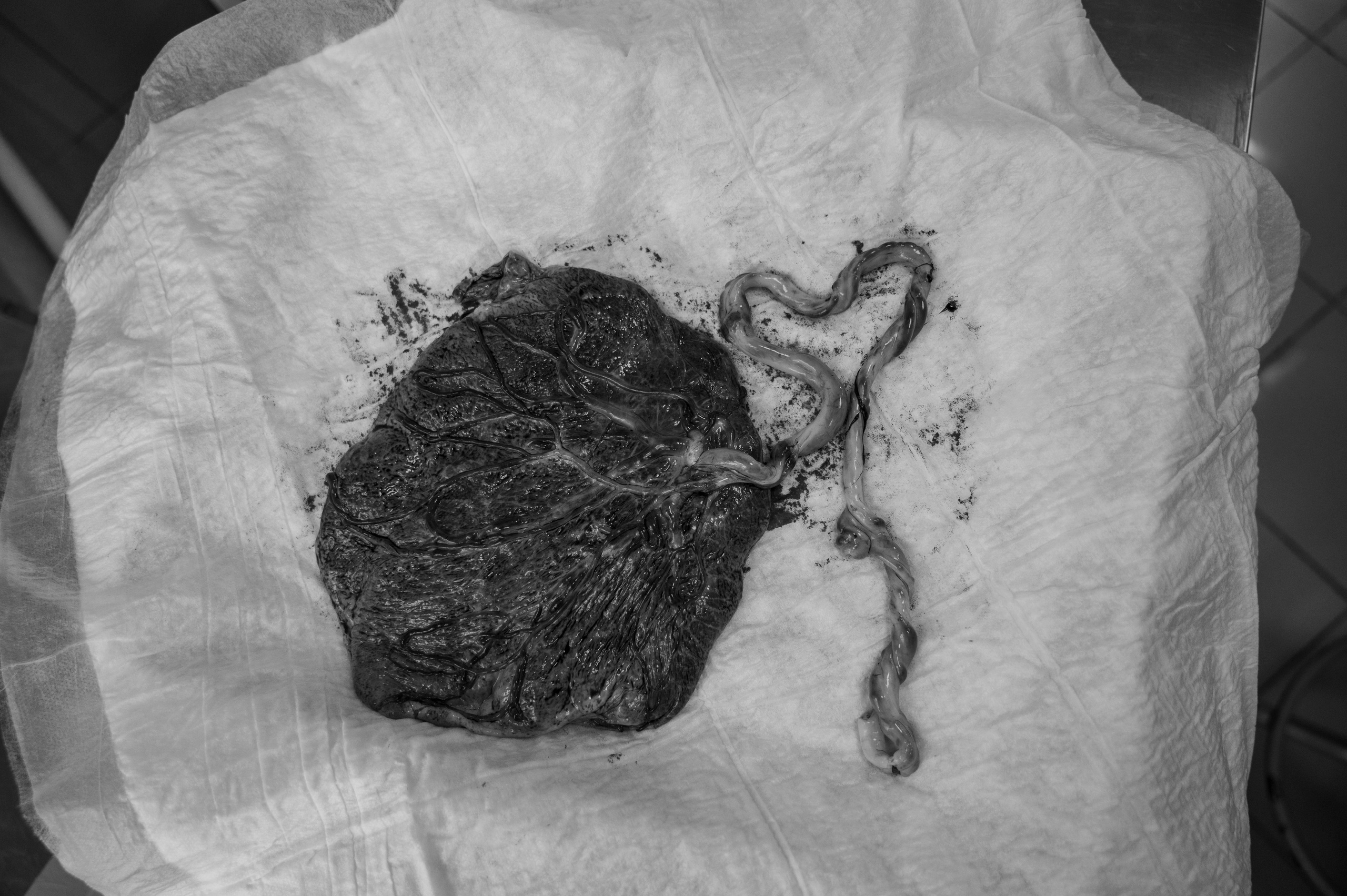 Злата родилась. Роддом № 17. Повидайка М.А. / Прохоренко Н.А. Фотограф на роды СПБ Юлия Герасимова