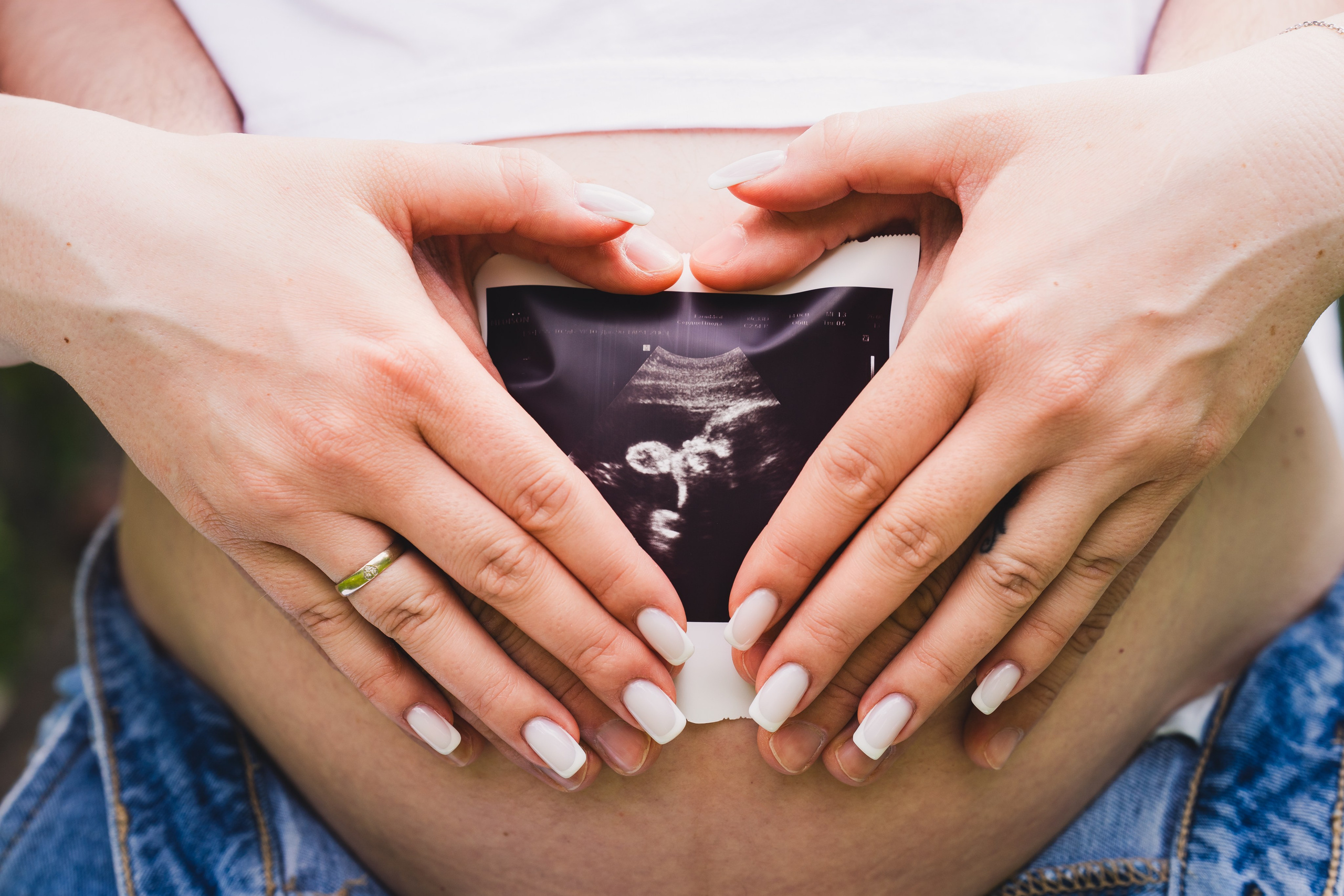 Гендер-пати на природе. Репортажный фотограф в Москве Легкая Софья