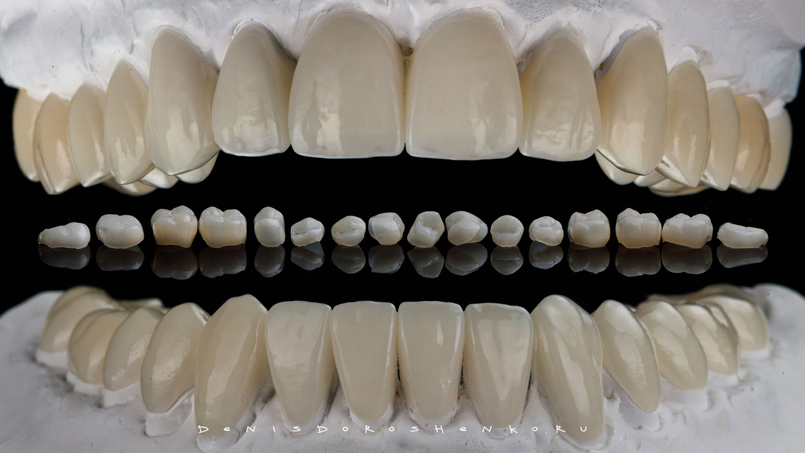 Ортопедия. Дентал фотограф — видеограф Денис Дорошенко