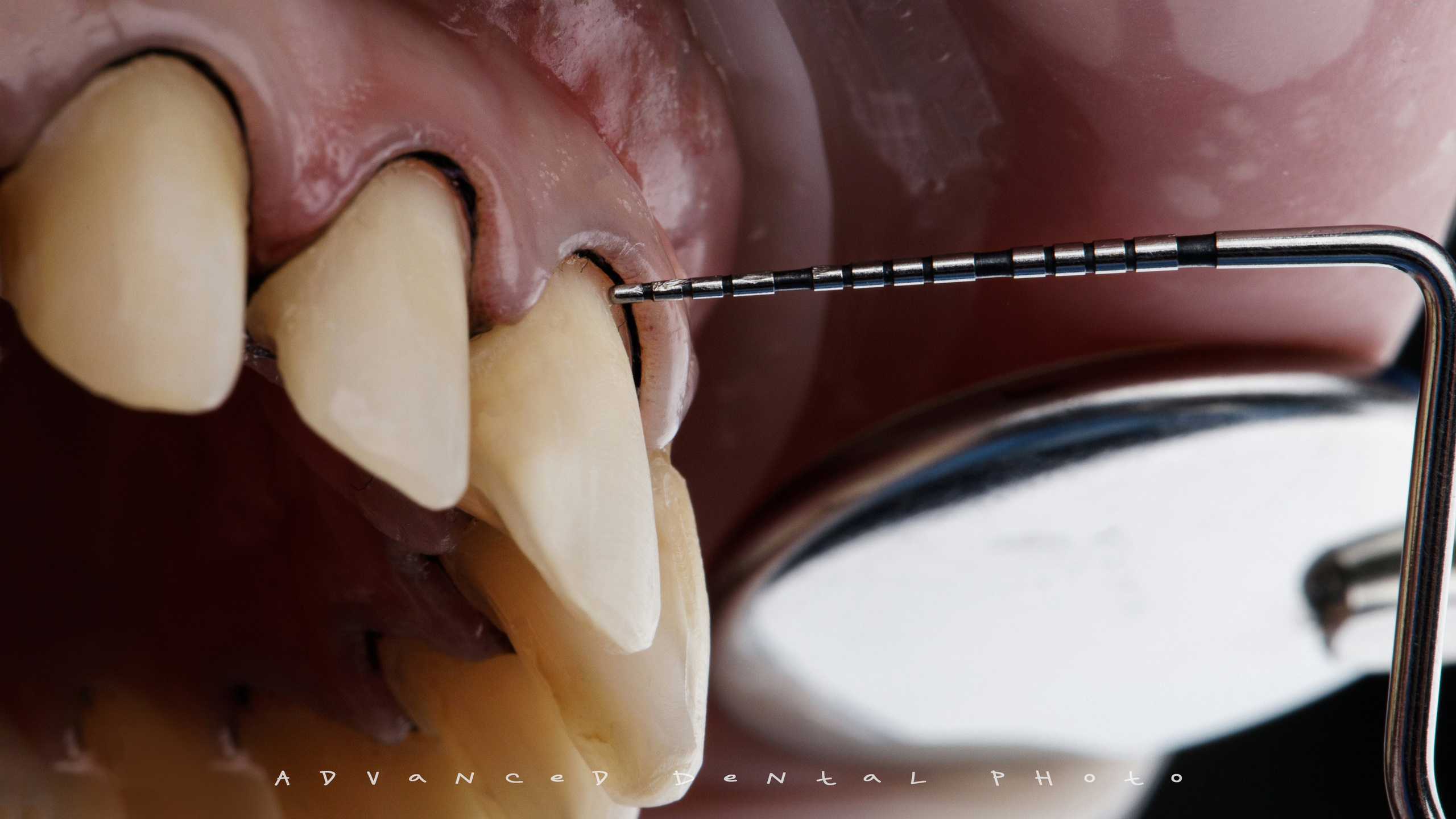 Ортопедия. Дентал фотограф — видеограф Денис Дорошенко