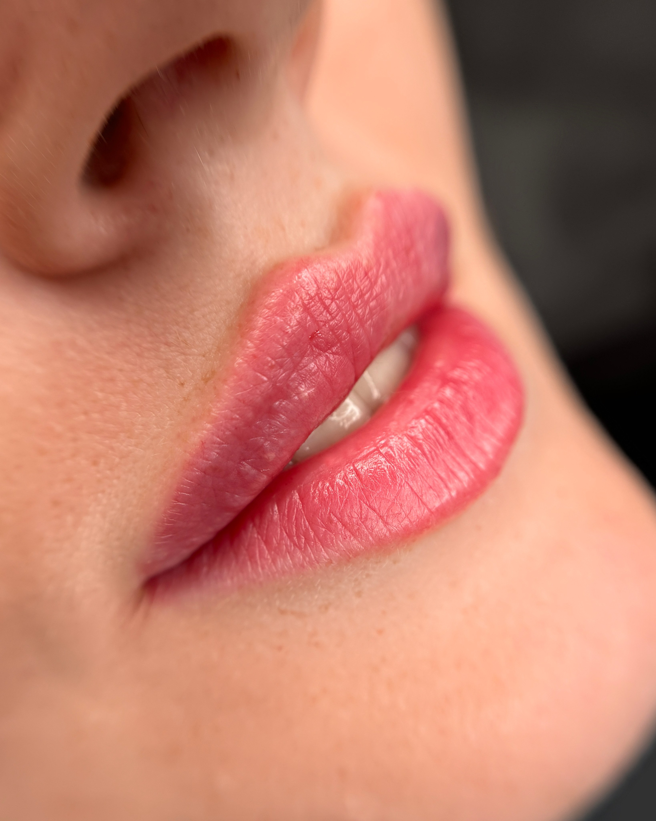 Инъекционная косметология. Студия перманентного макияжа, косметологии и массажа SYMMETRY в Москве, м. Киевская