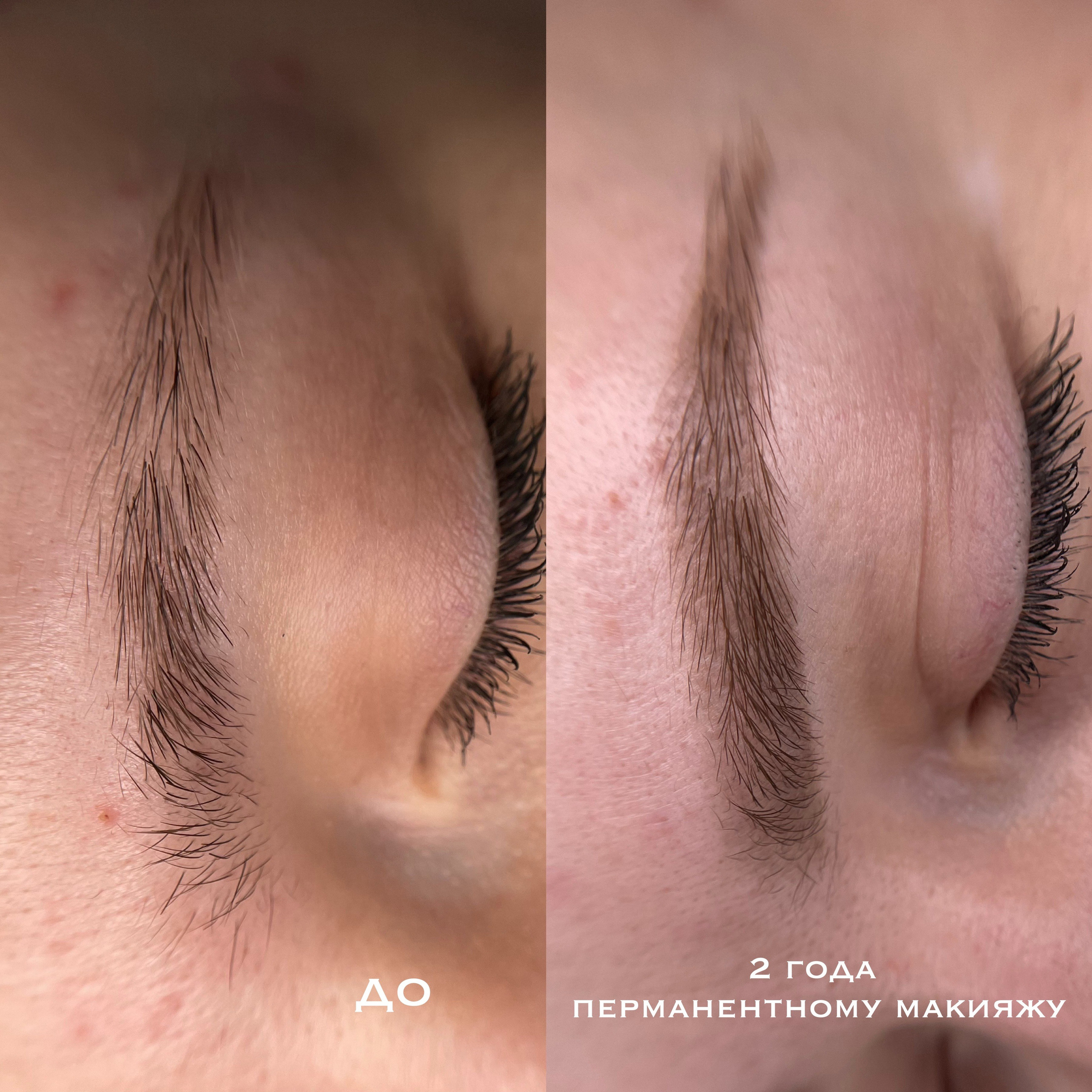 БРОВИ зажившие. Перманентный макияж и удаление старого татуажа в Ростове-на-Дону Дарья Исакова
