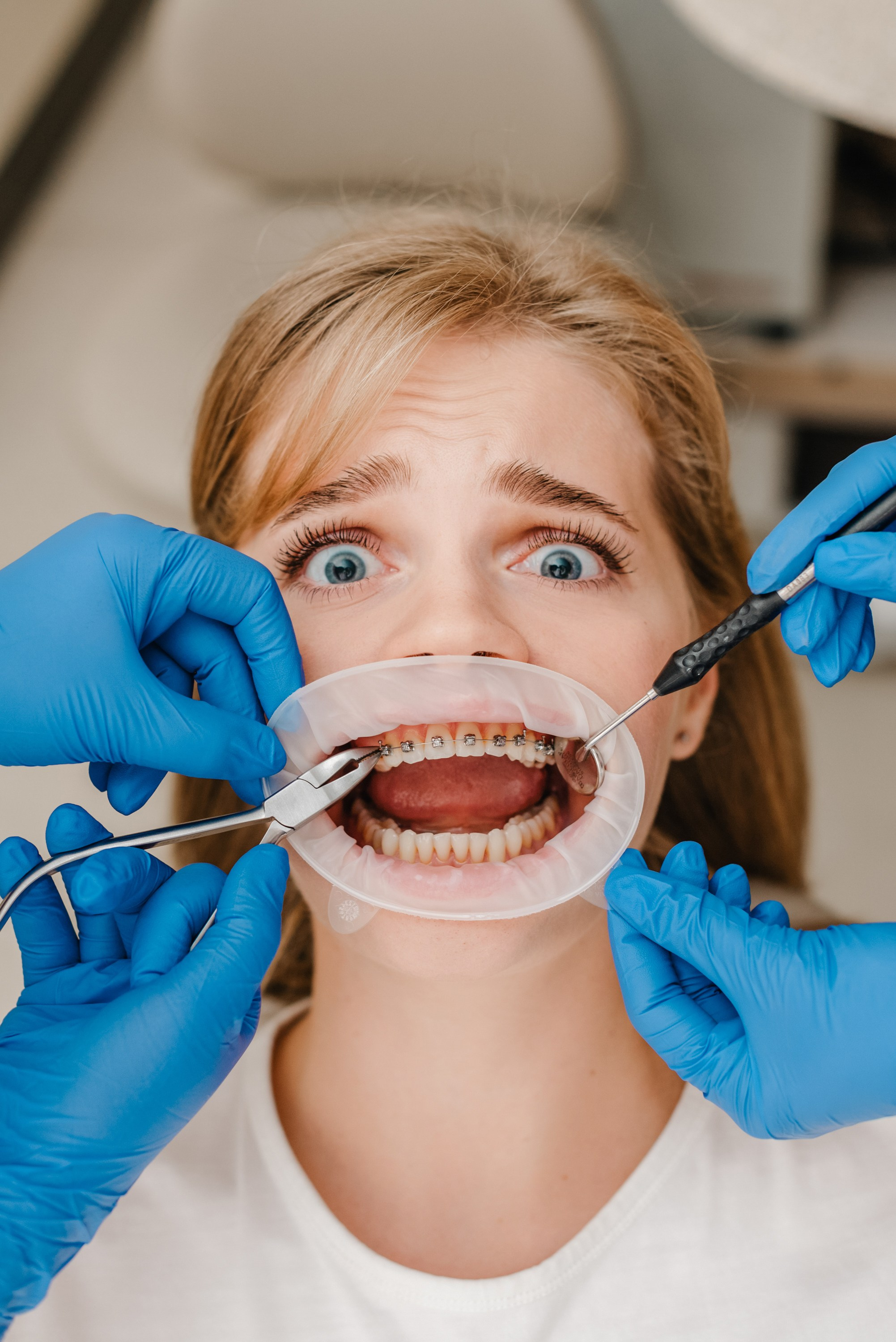 СТОМАТОЛОГИЯ. Шашкова Вероника / Свадебный и семейный фотограф Москва и Ярославль