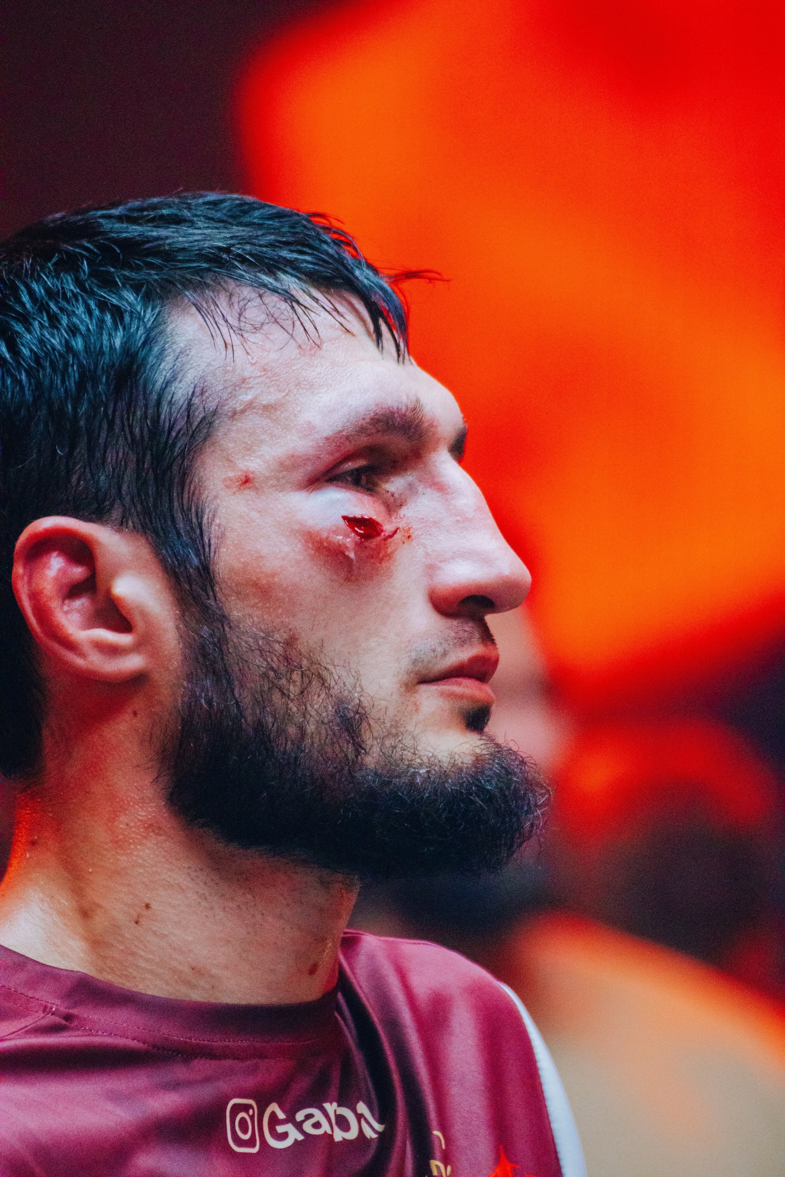 Кулачные бои TopDog. Анастасия Тен