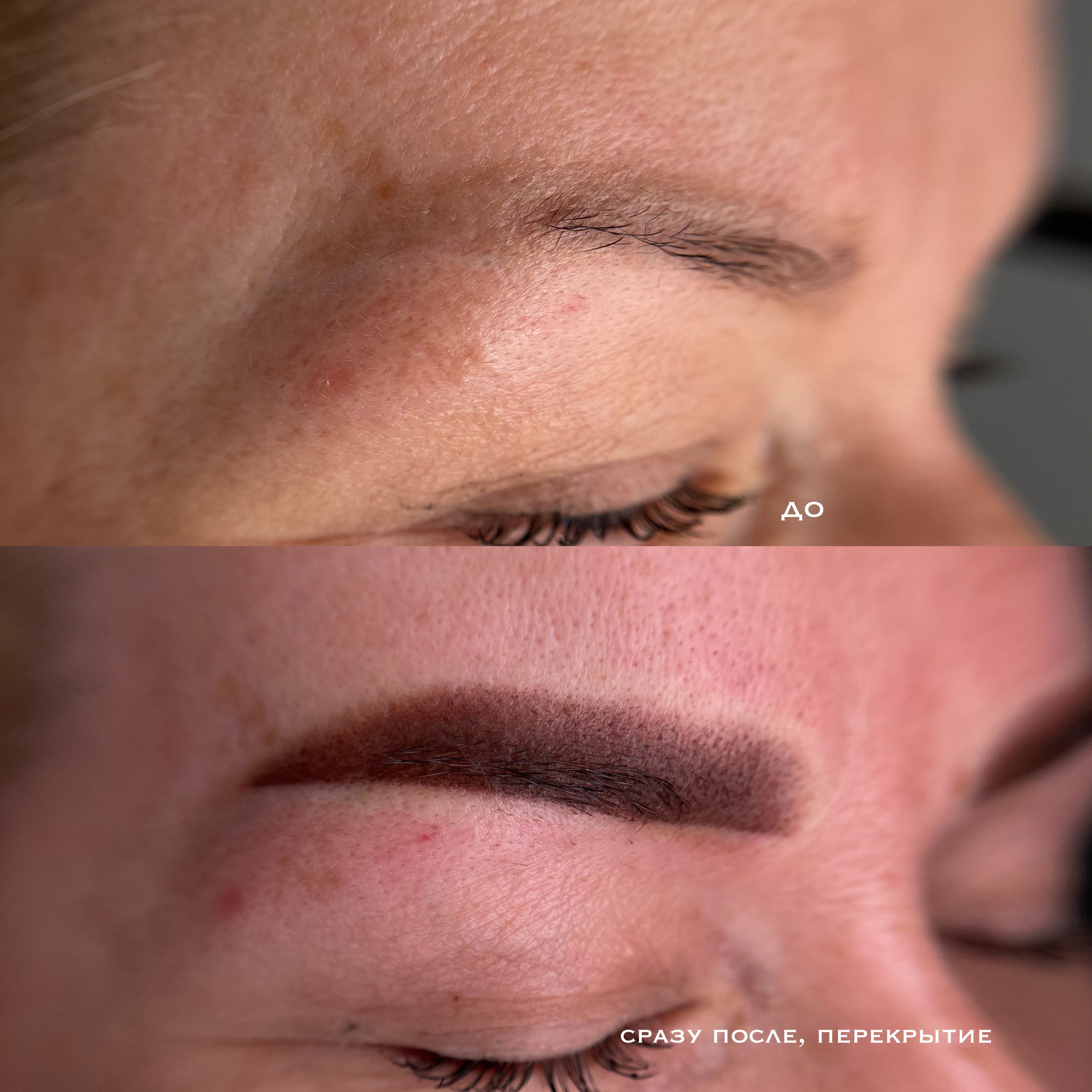 БРОВИ сразу после процедуры. Перманентный макияж и удаление старого татуажа в Ростове-на-Дону Дарья Исакова