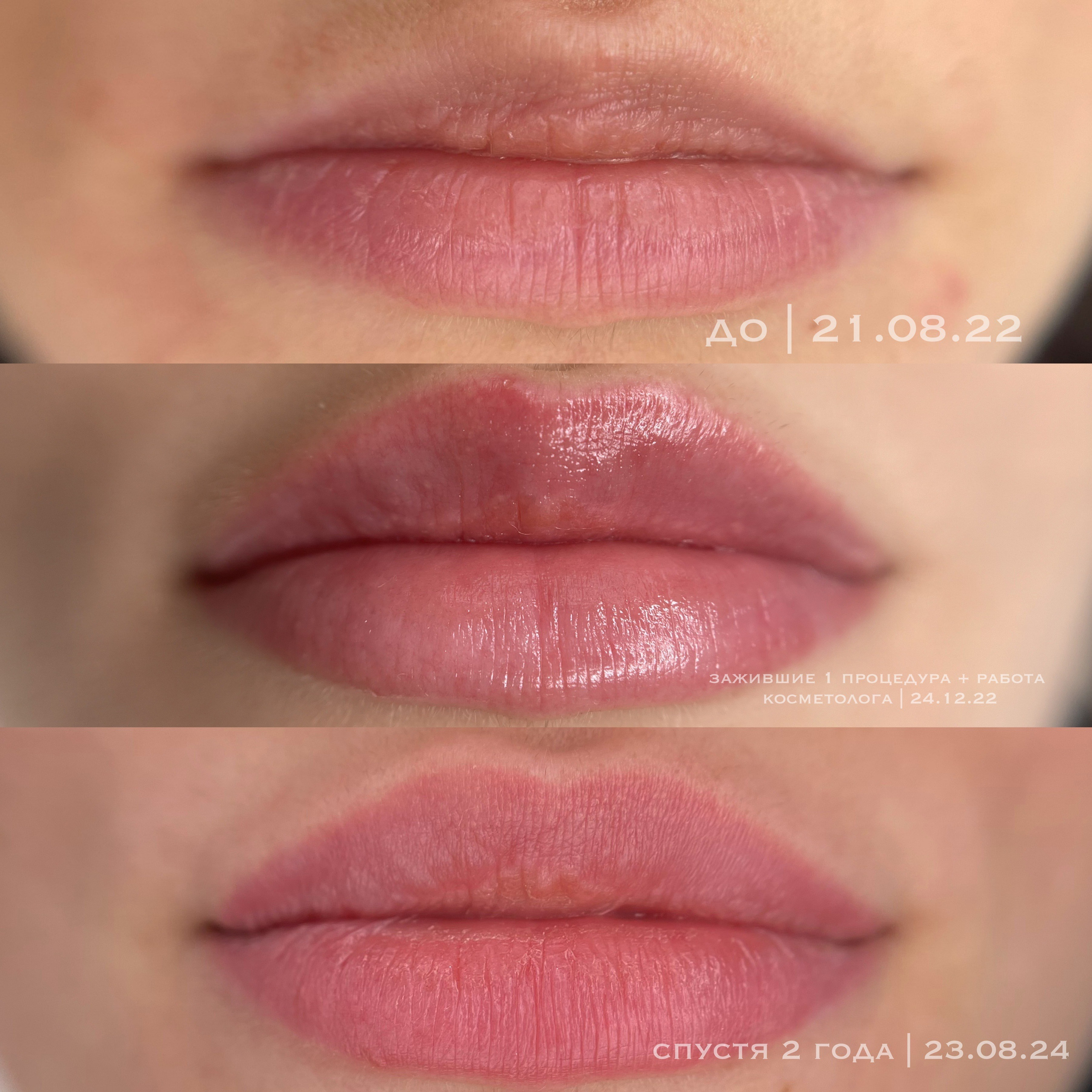 ГУБЫ зажившие. Перманентный макияж и удаление старого татуажа в Ростове-на-Дону Дарья Исакова