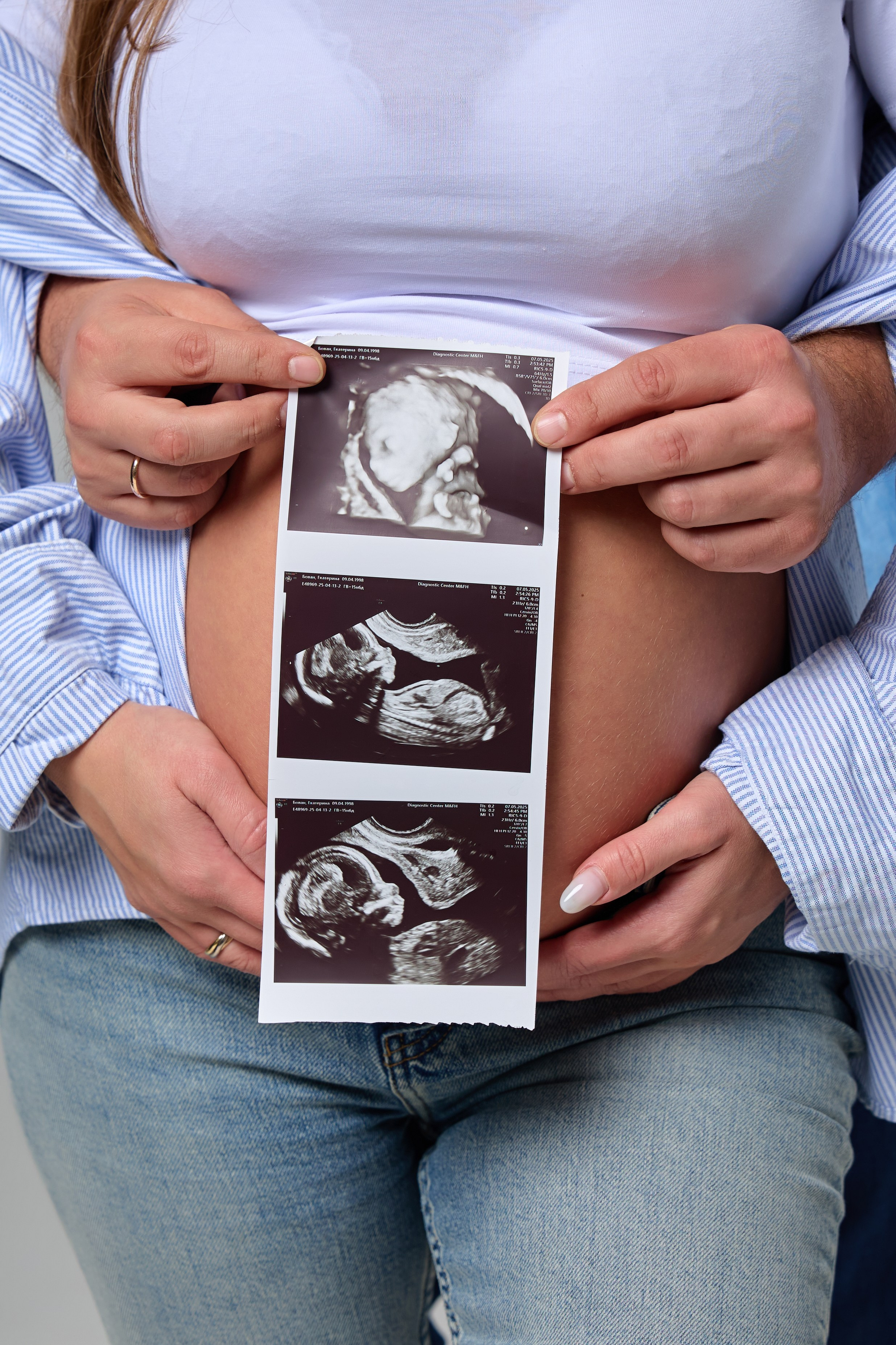 Катерина. Pregnancy. Фотограф Люся Воробьева