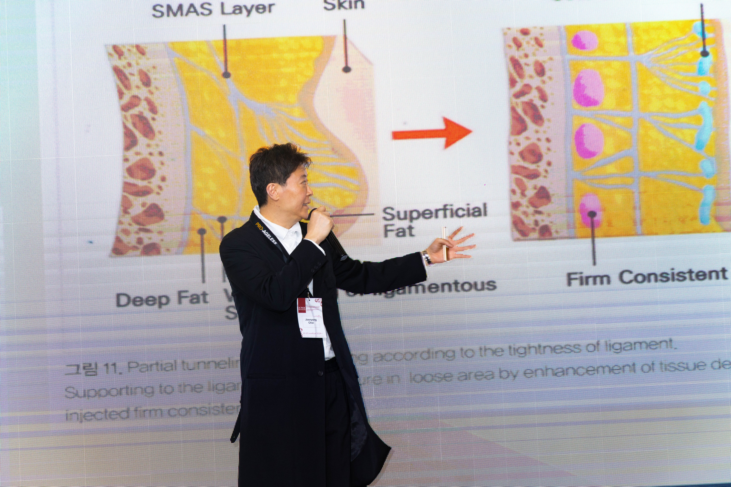 СПИКЕРЫ. PRO-AGELESS