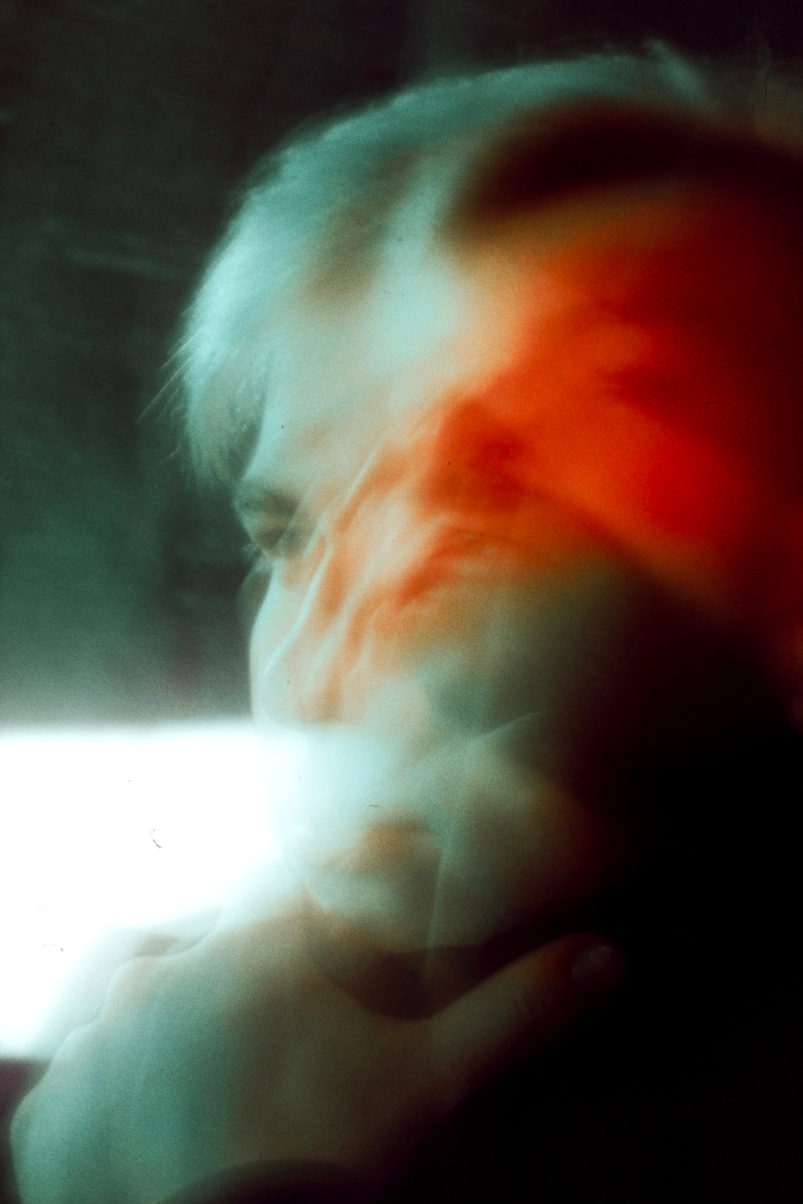 Компьютерная томография и мрт