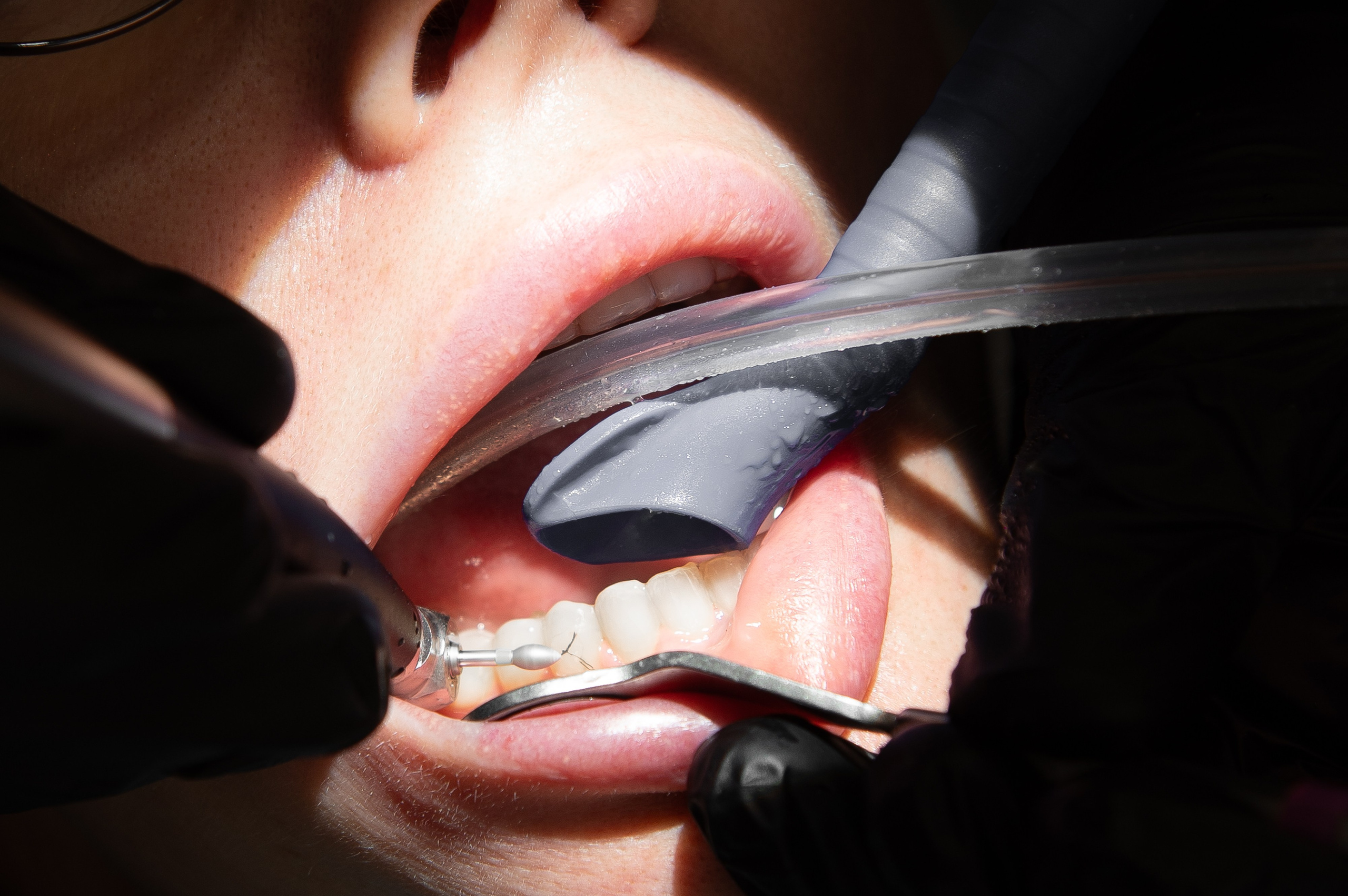 Стоматология «АрияДент». Фотограф Дмитрий Пименов