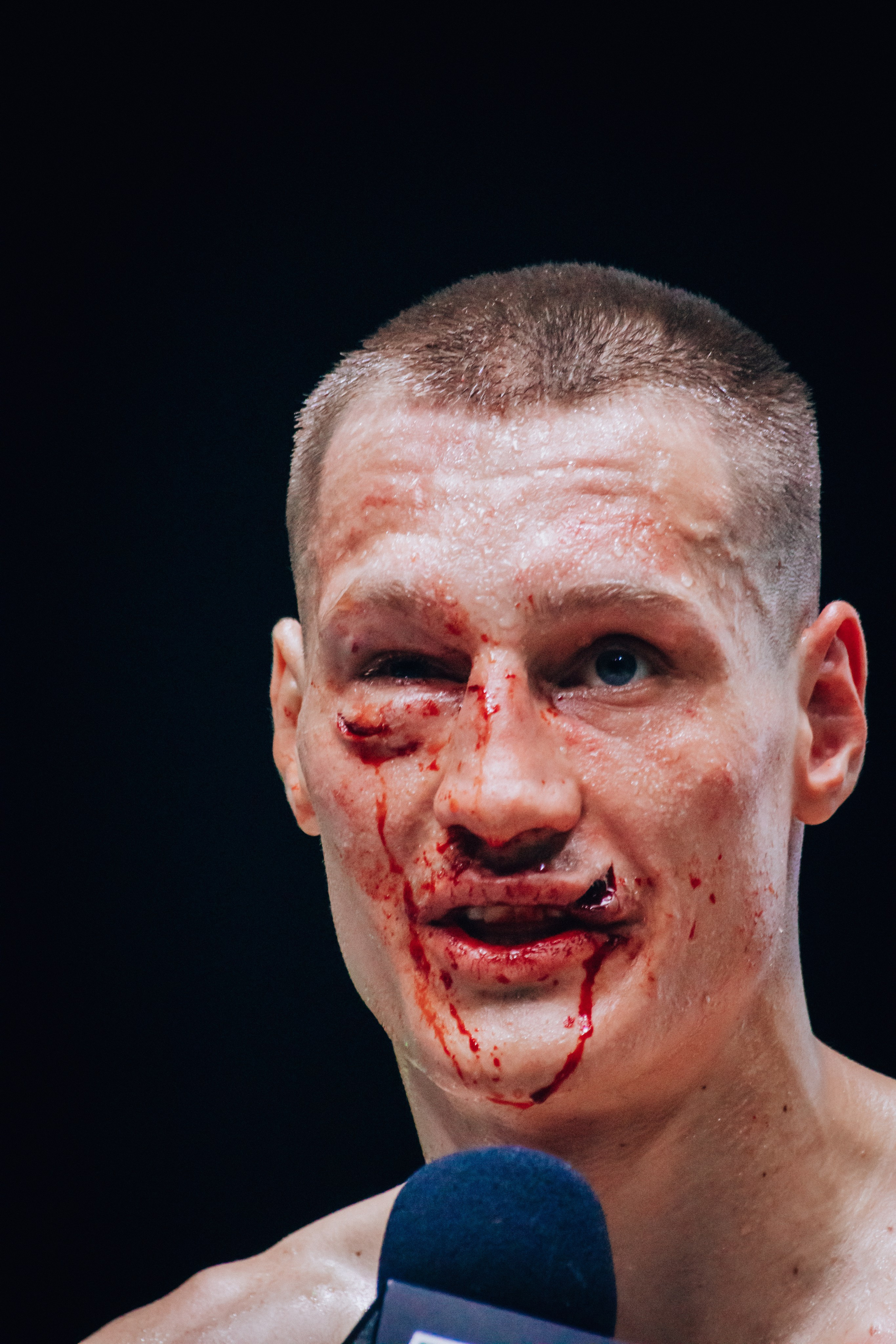 Кулачные бои TopDog. Анастасия Тен