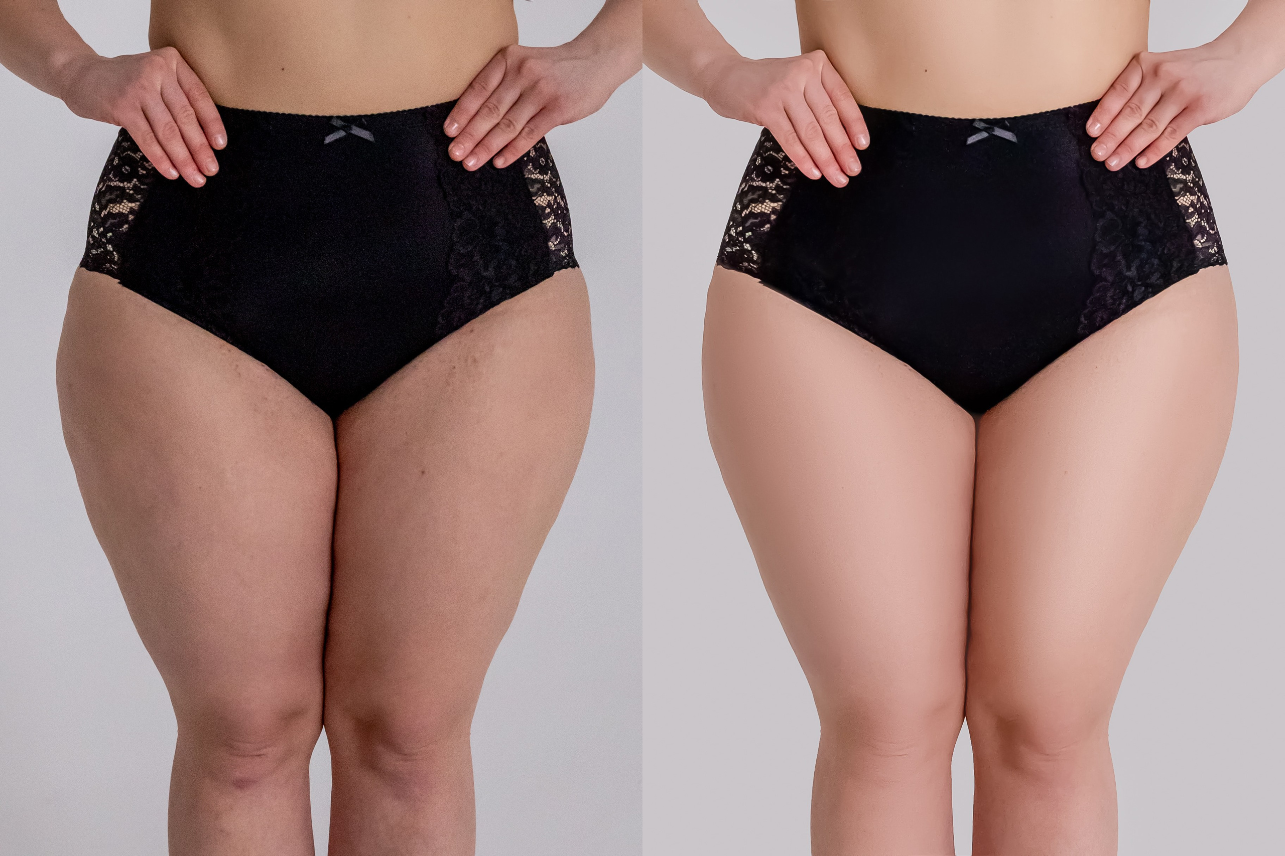 Деликатная обработка портретов для рекламы нижнего белья | Студия SVITHART