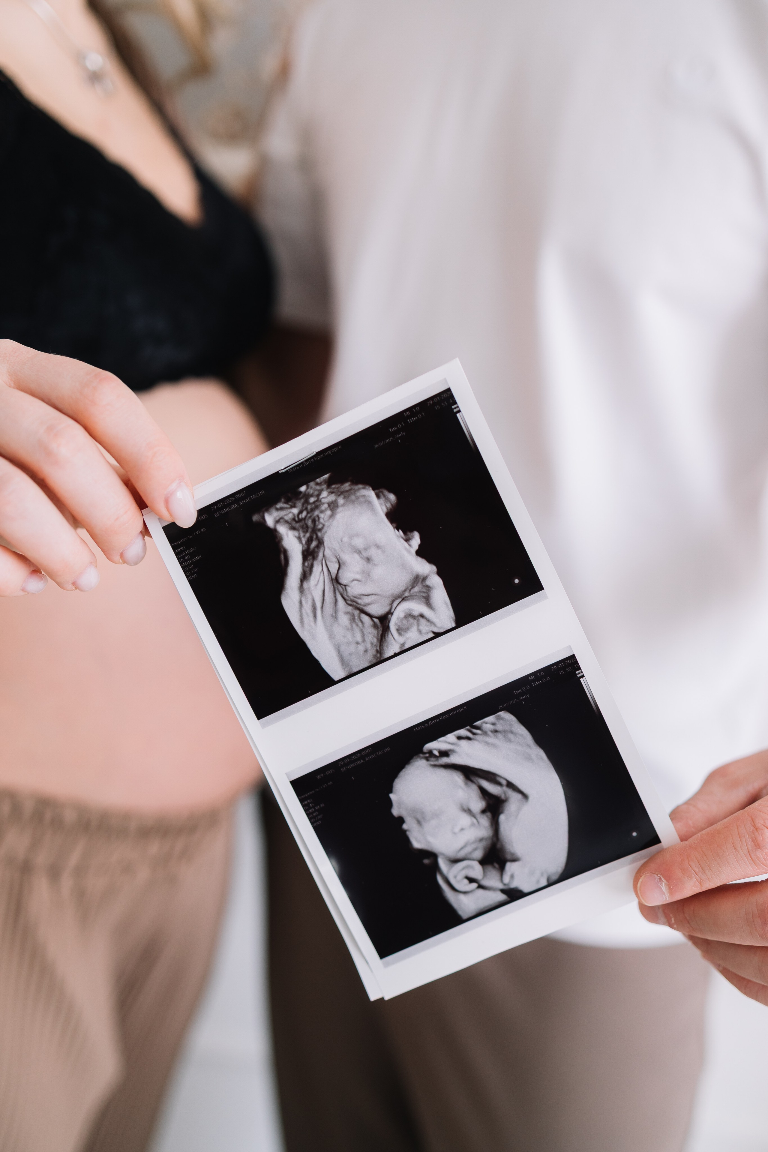 Фотосессия беременности. Свадебный фотограф Санкт-Петербург—Москва/Юлия Малькова