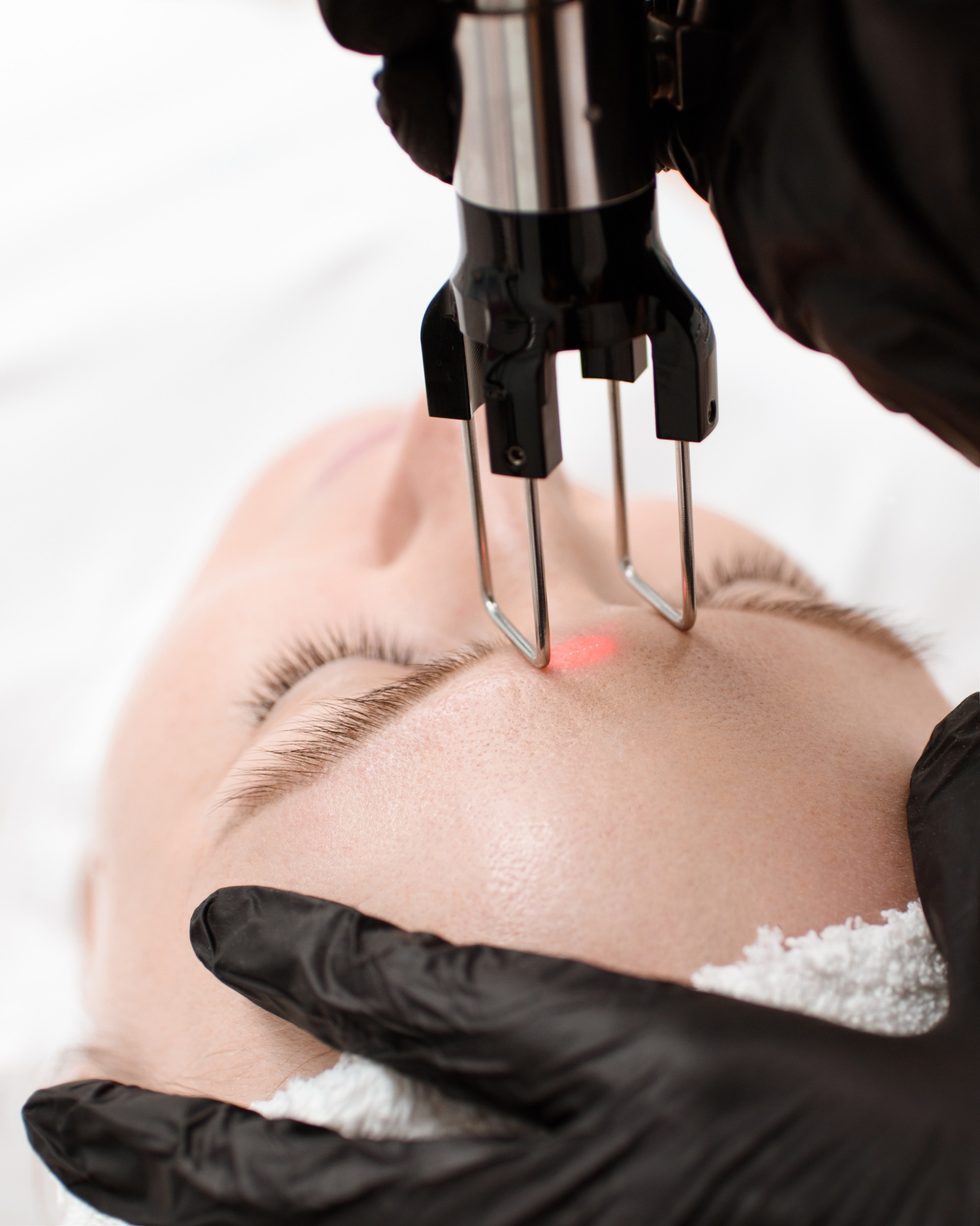 Клиника косметологии «MY COSMO». Фотосъемка для брендов, маркетплейсов, персональные съемки | Катерина Михеева | Пермь