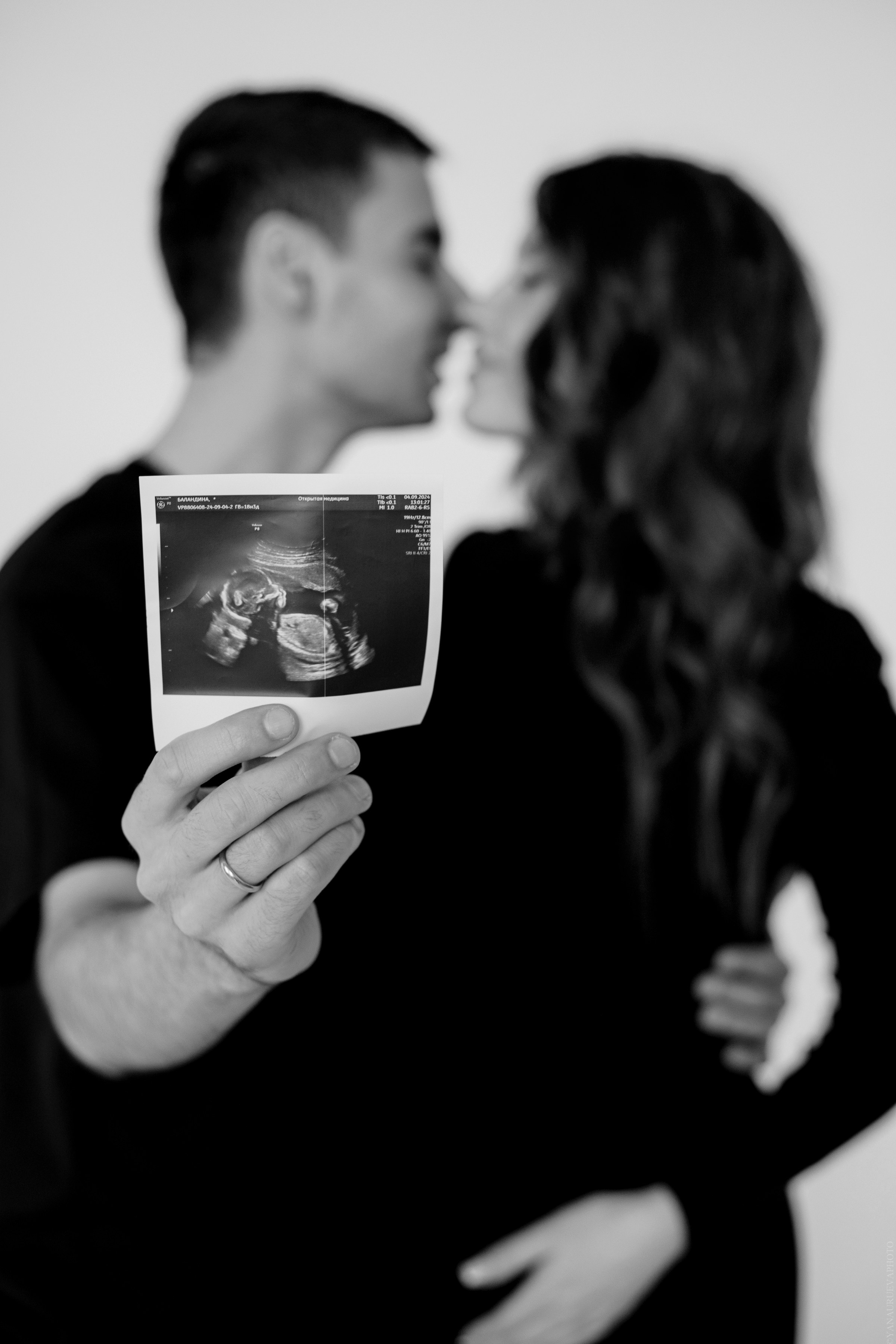 фото беременности и снимок с узи